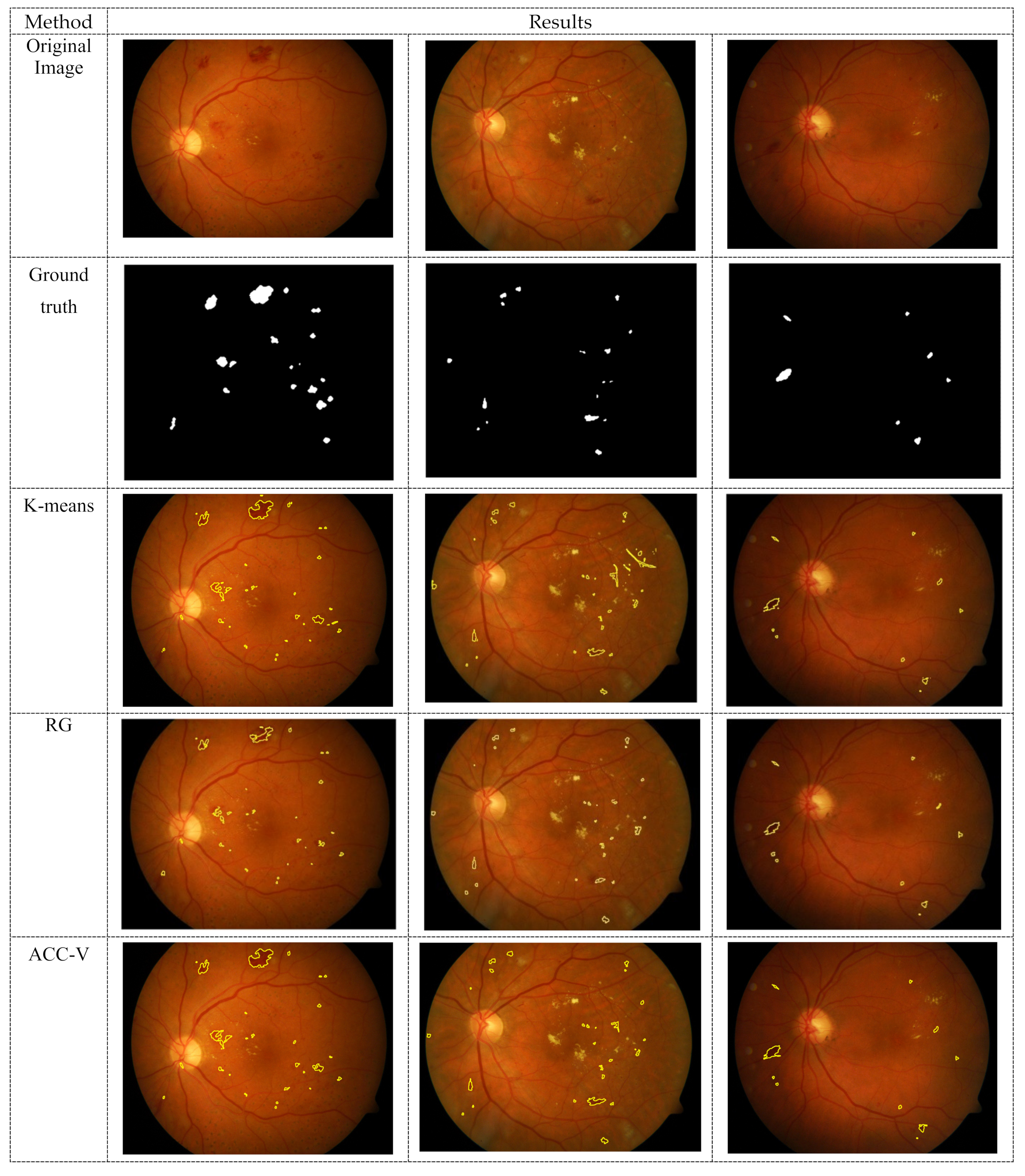 Applsci 11 06391 g006a