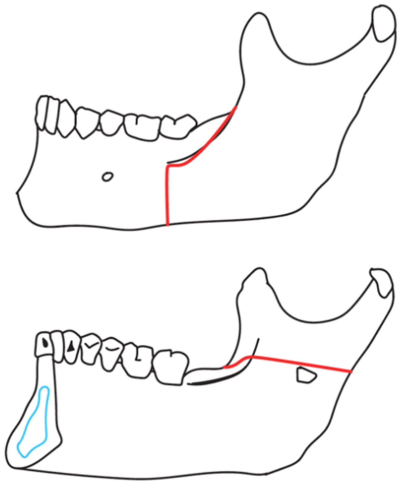 Applied Sciences Free FullText Current Trends in Orthognathic