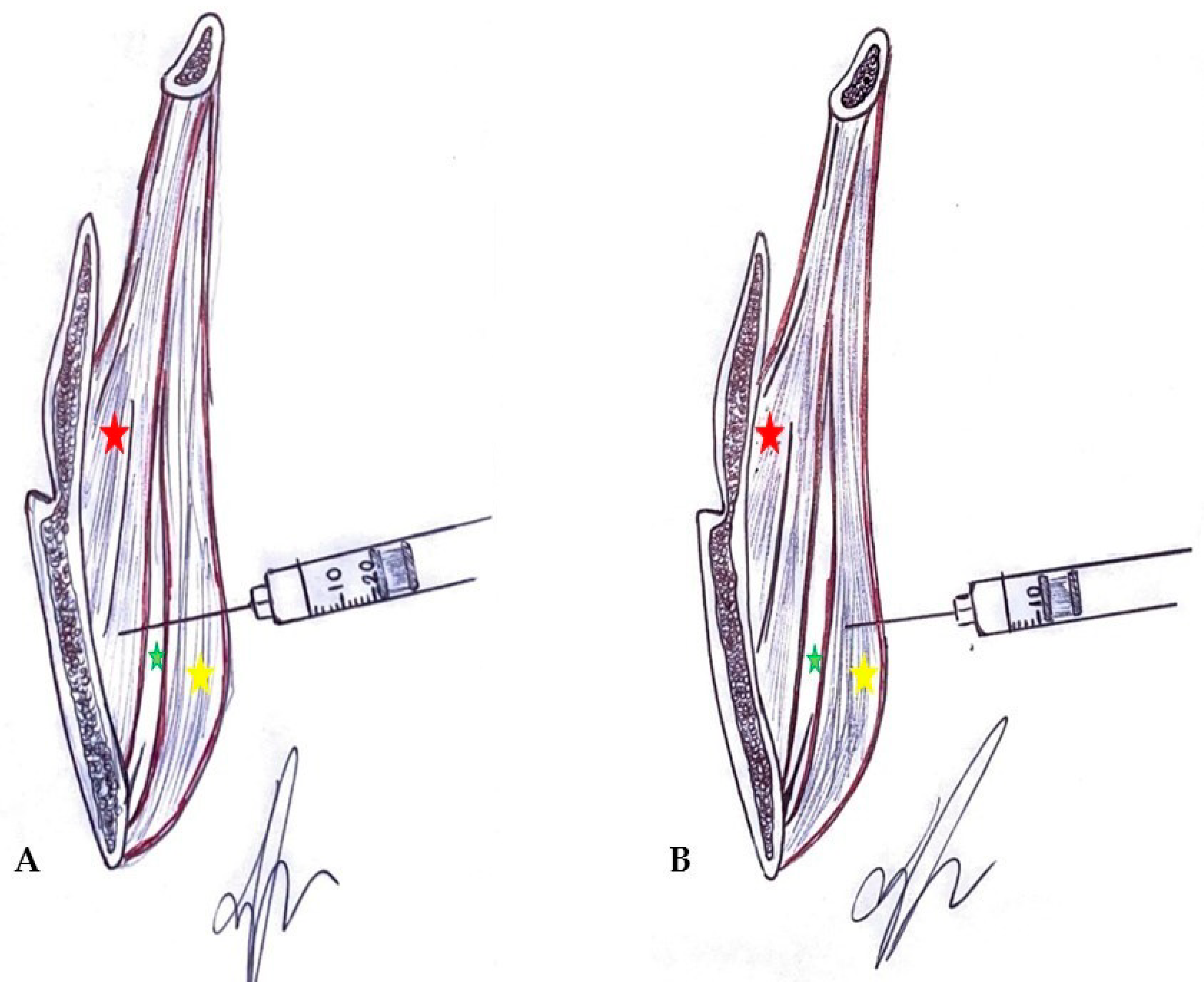 Applsci 11 06478 g003