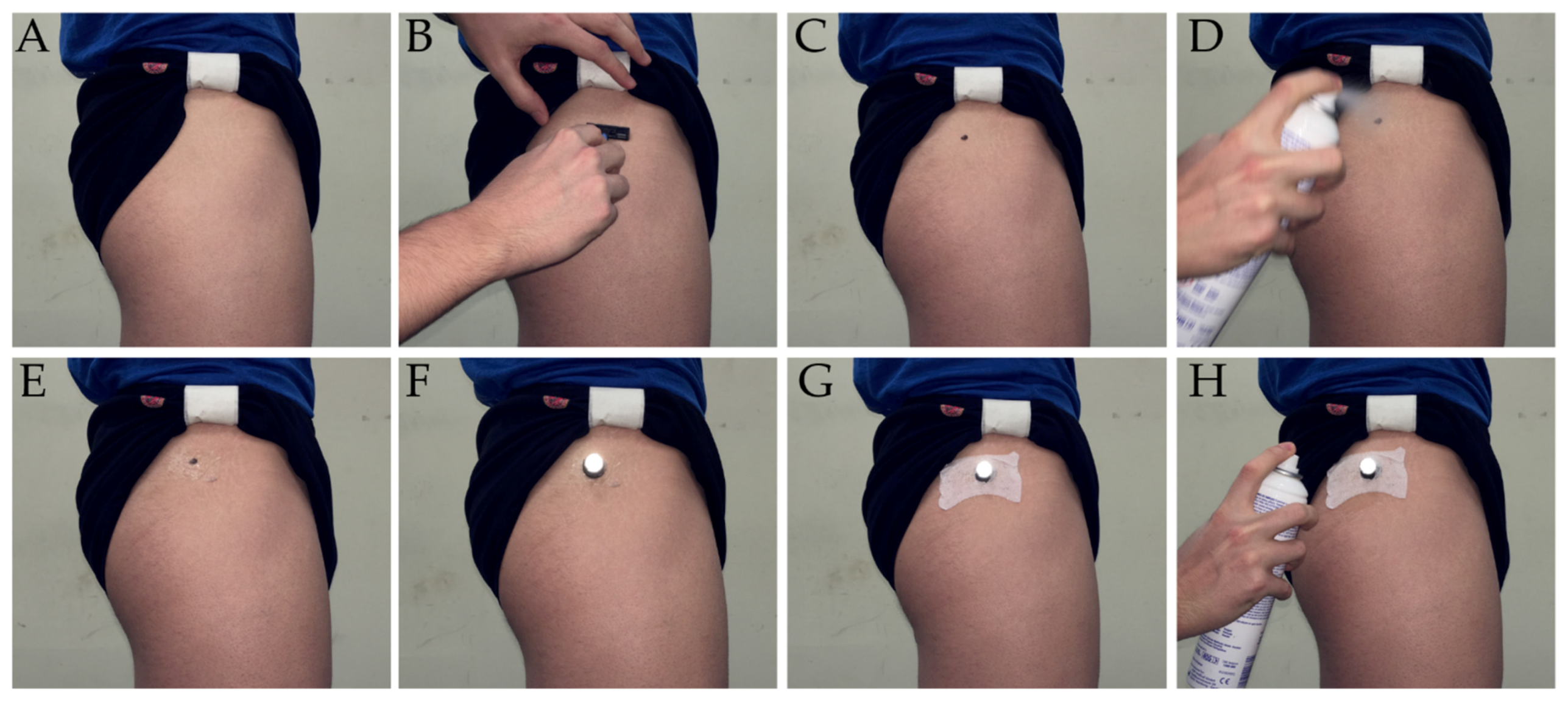 Applsci 11 06610 g002 Applsci 11 06610 g002