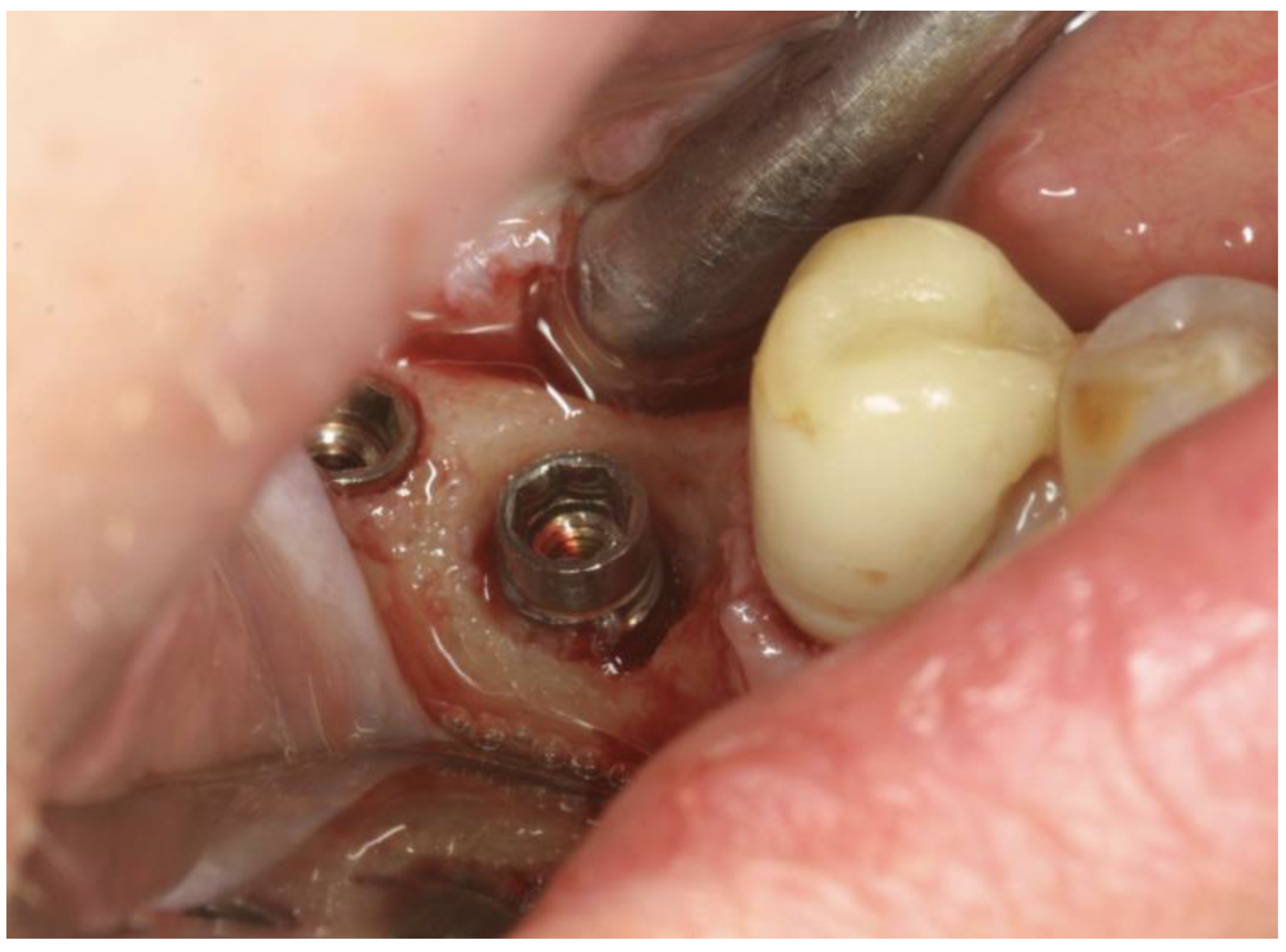 Applsci 11 06771 g002 550