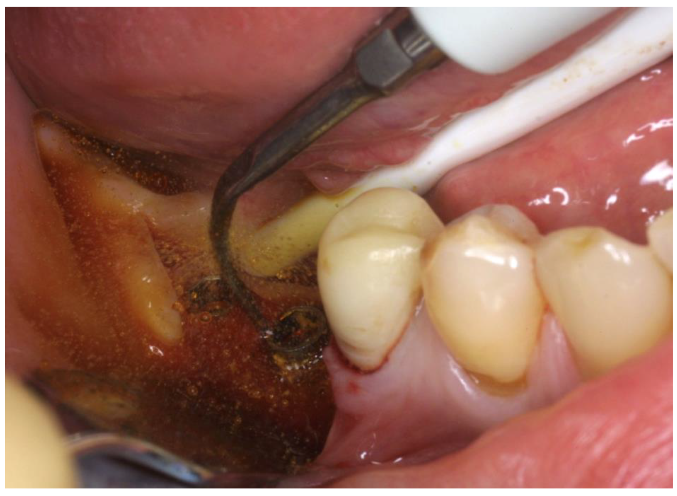 Applsci 11 06771 g003 550