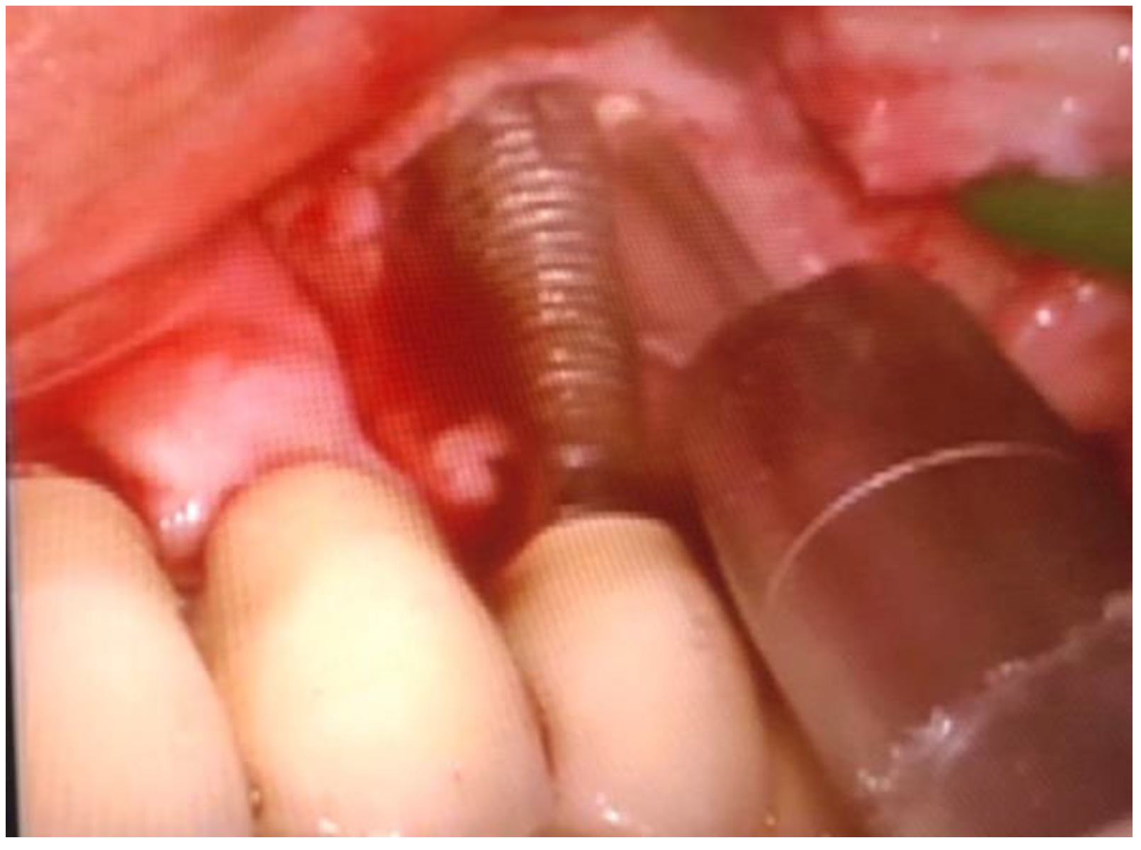 Applsci 11 06771 g005 550