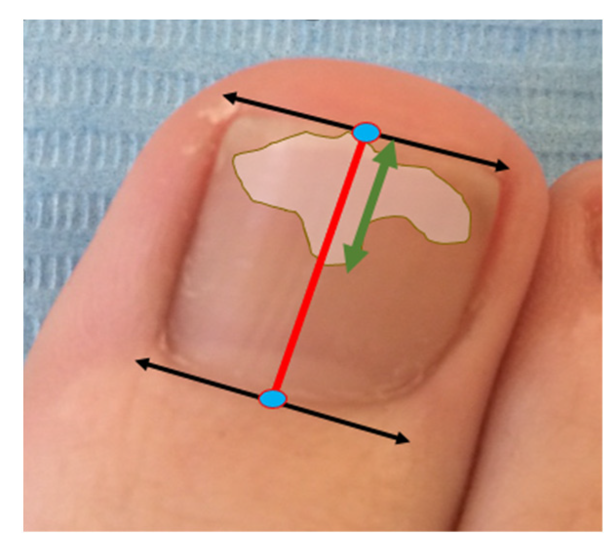 Applsci 11 06817 g001 550