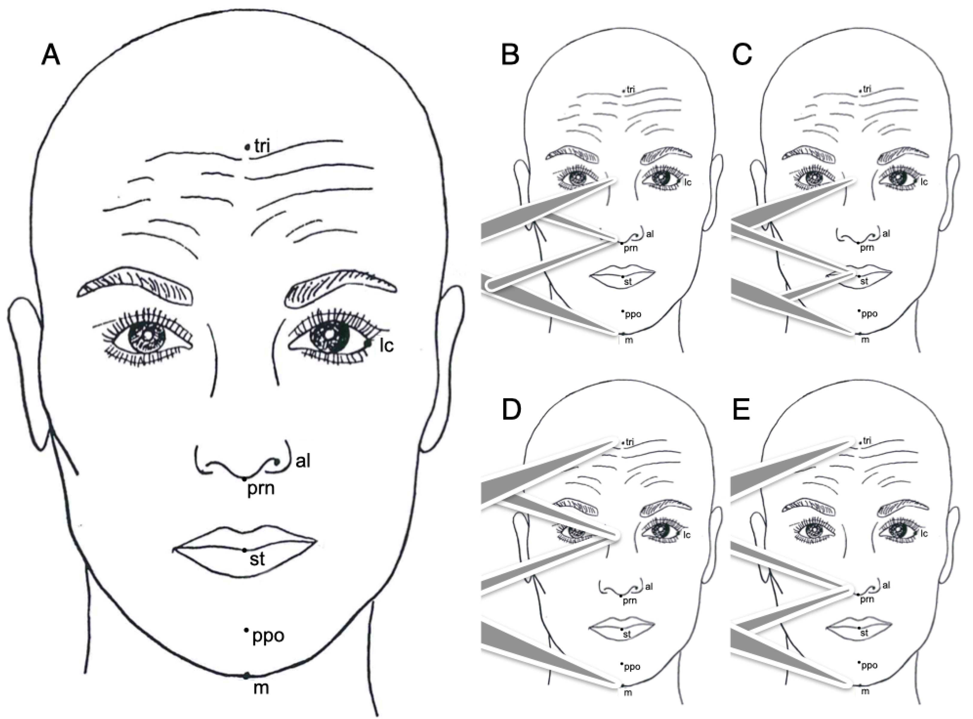 Essential requirements of a non-occlusal mandibu- lar reference position