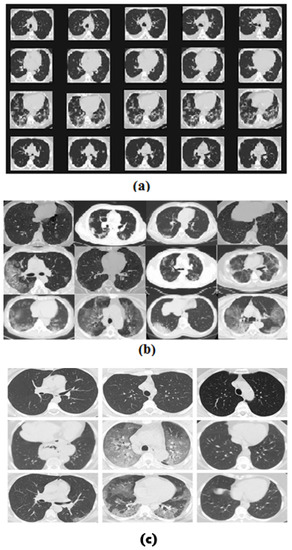 Prediction of COVID-19 from Chest CT Images Using an Ensemble of Deep ...