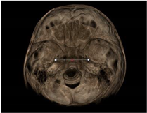 Applsci 11 07110 i002