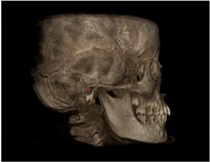 Applsci 11 07110 i003