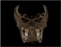 Applsci 11 07110 i004