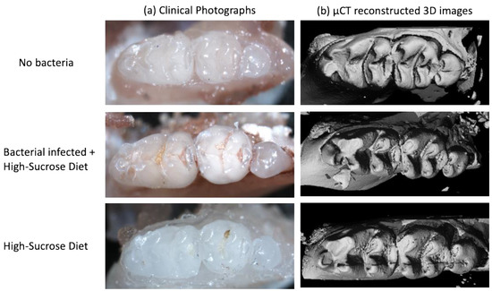 Mean scores for dental caries in the mandibu- lar molars of each group.