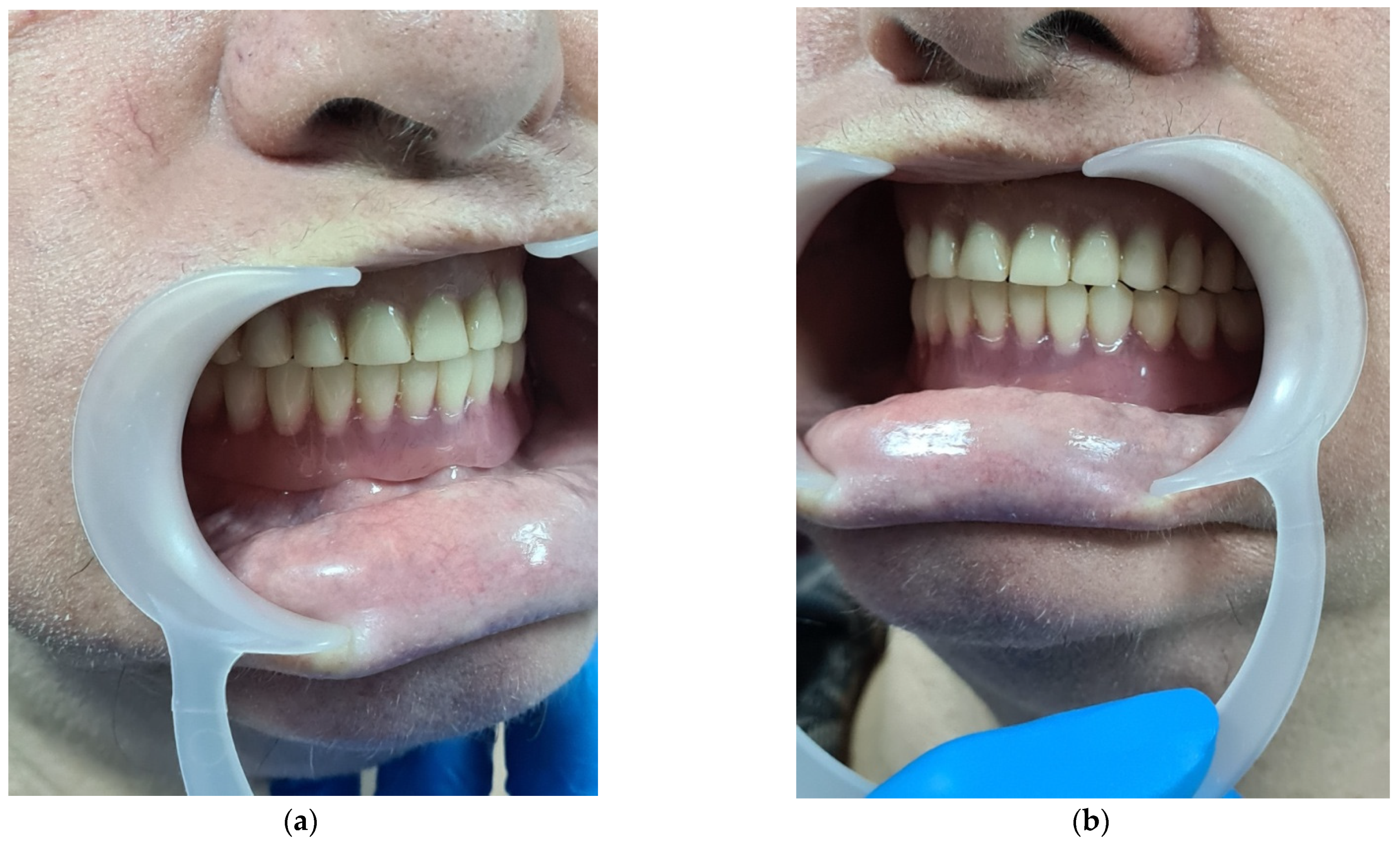 Applsci 11 07386 g016 550