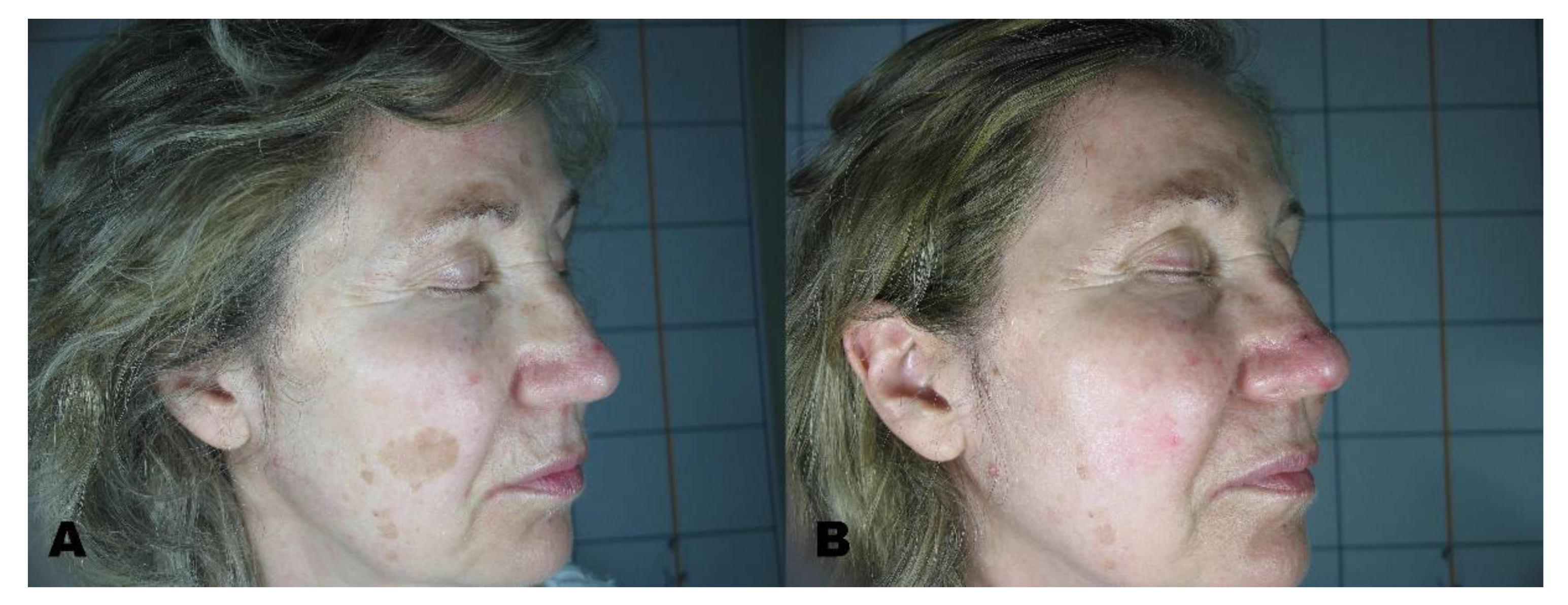 Applsci 11 07478 g002