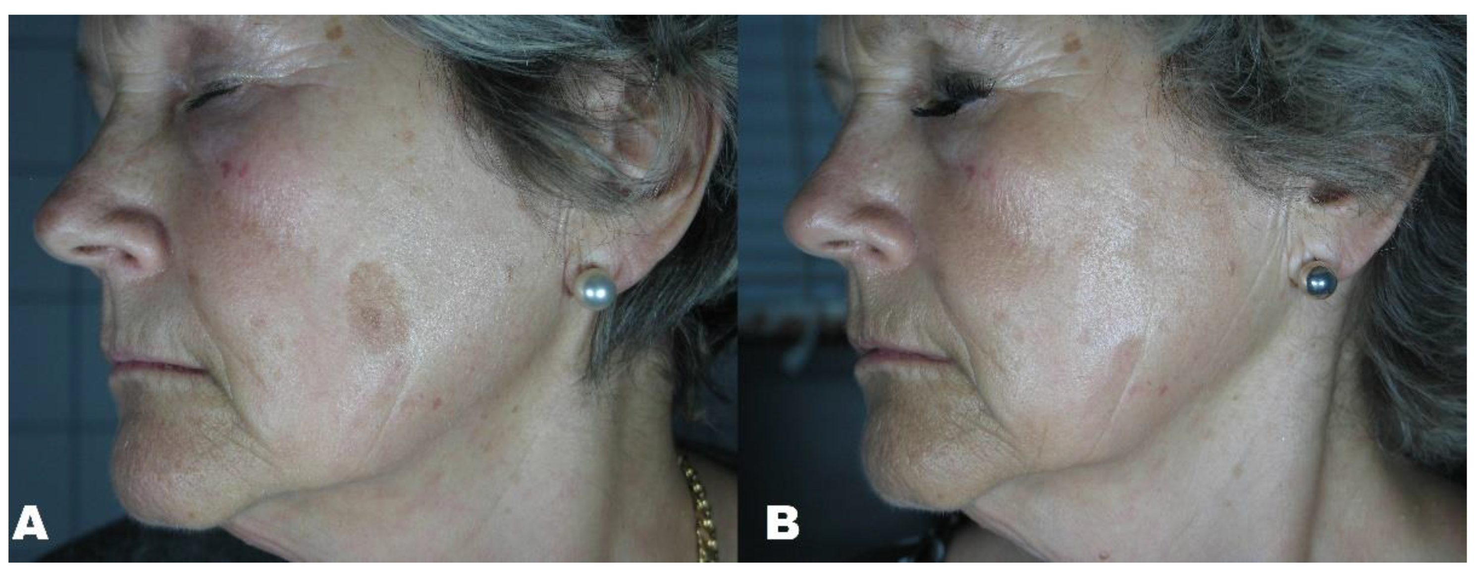 Applsci 11 07478 g006