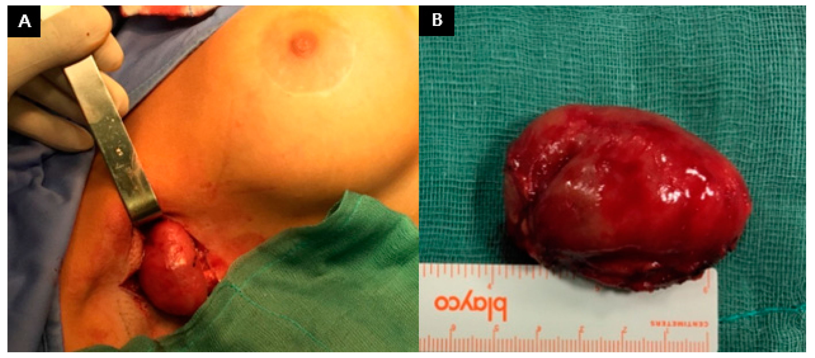 Applsci 11 07493 g005 550