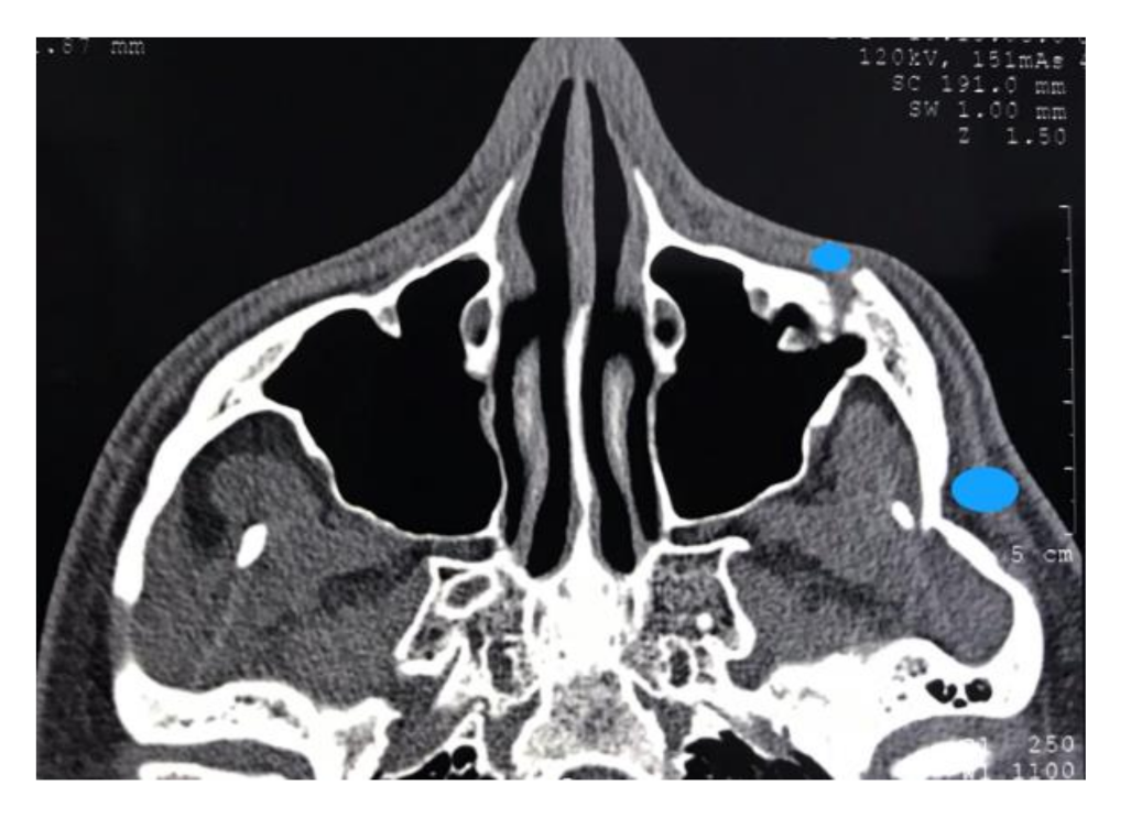 Xray Scan - Frighten Wife KW, PDF