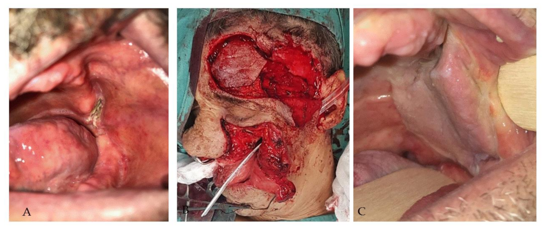 Applsci 11 07507 g013 Applsci 11 07507 g013