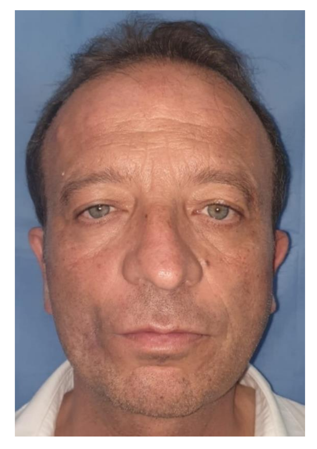 Applsci 11 07507 g017 Applsci 11 07507 g017