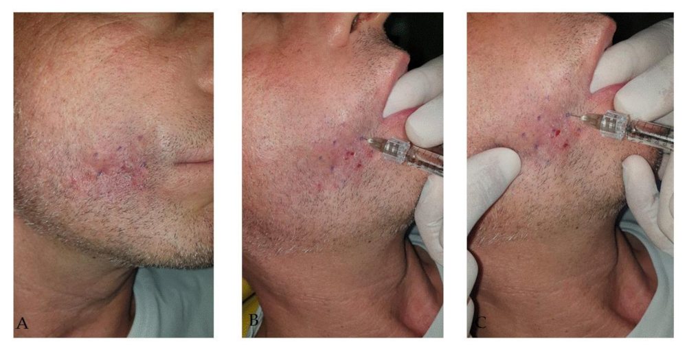 Applsci 11 07507 g018 Applsci 11 07507 g018