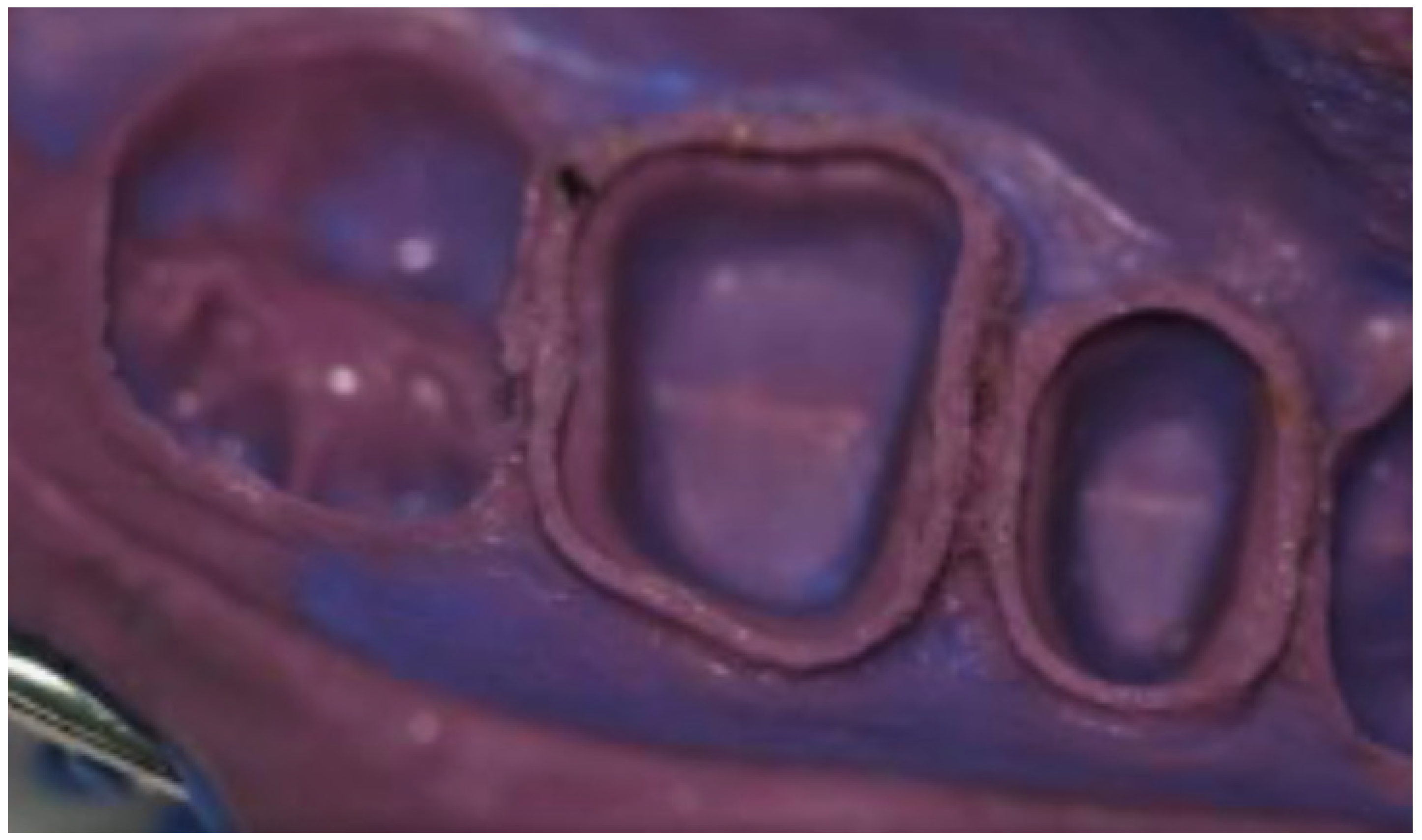 Applied Sciences Free FullText Effect of Mixing and Impression Techniques Using Vinyl