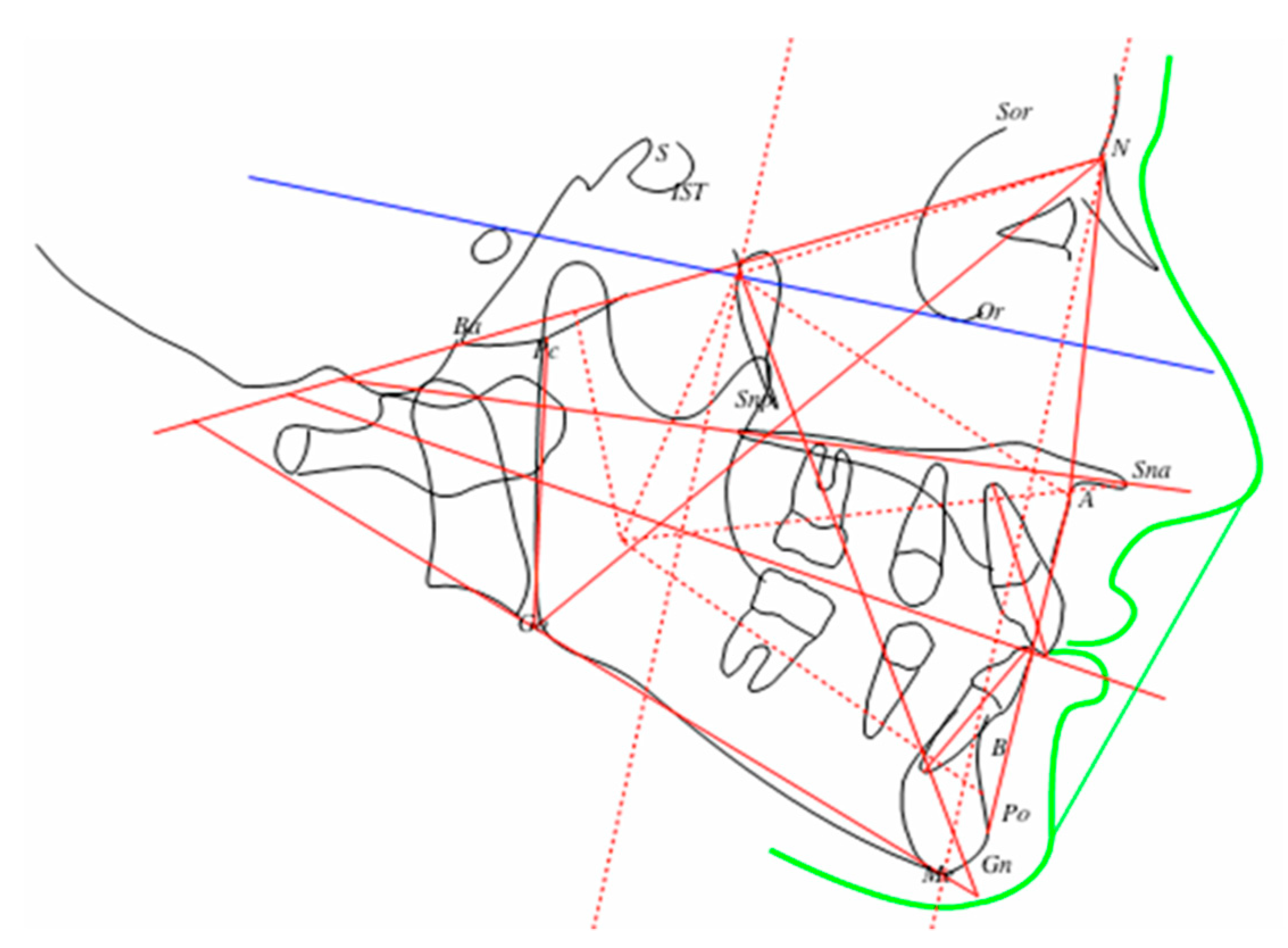 Applsci 11 07869 g002