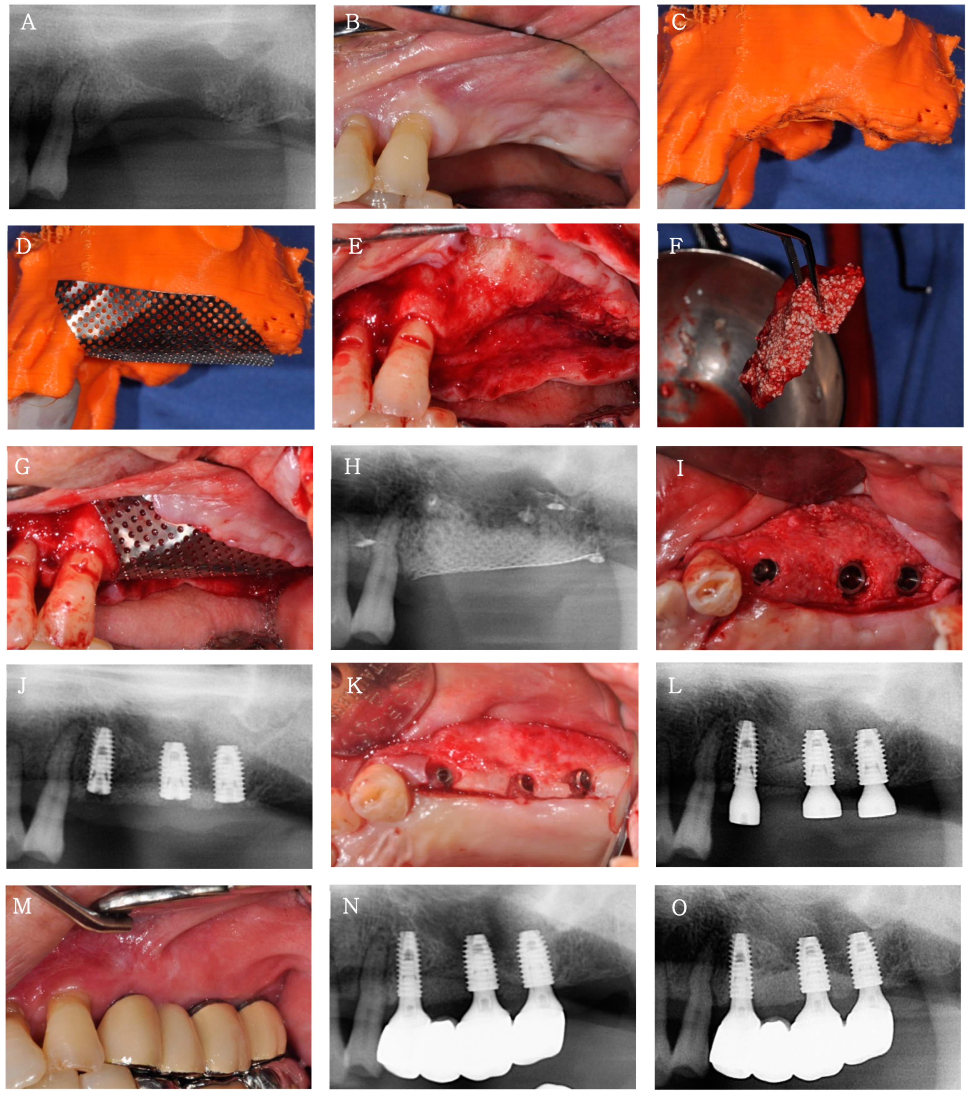 Applsci 11 07921 g005 550