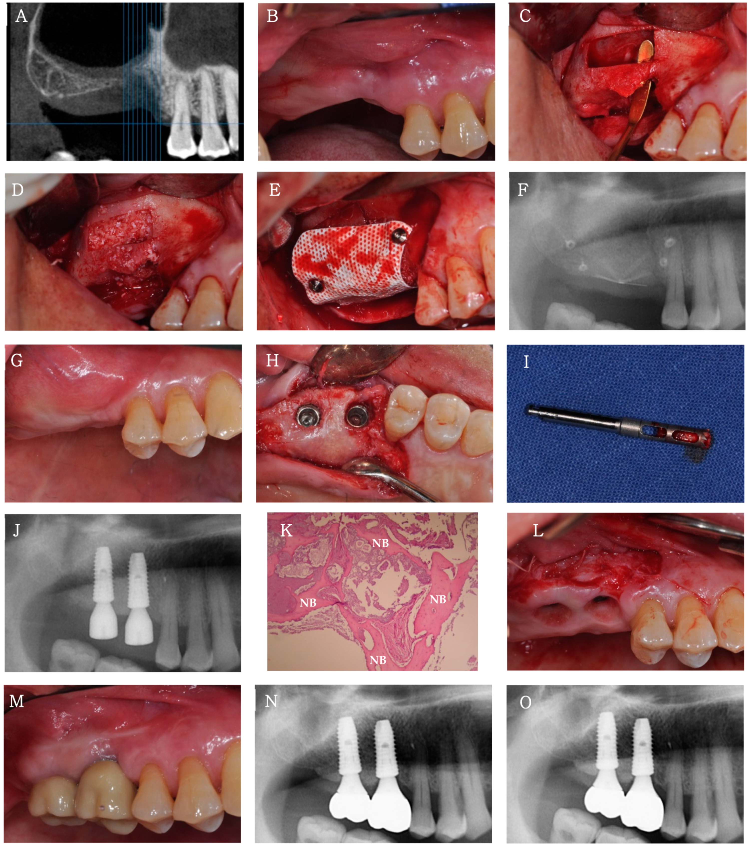 Applsci 11 07921 g006 550