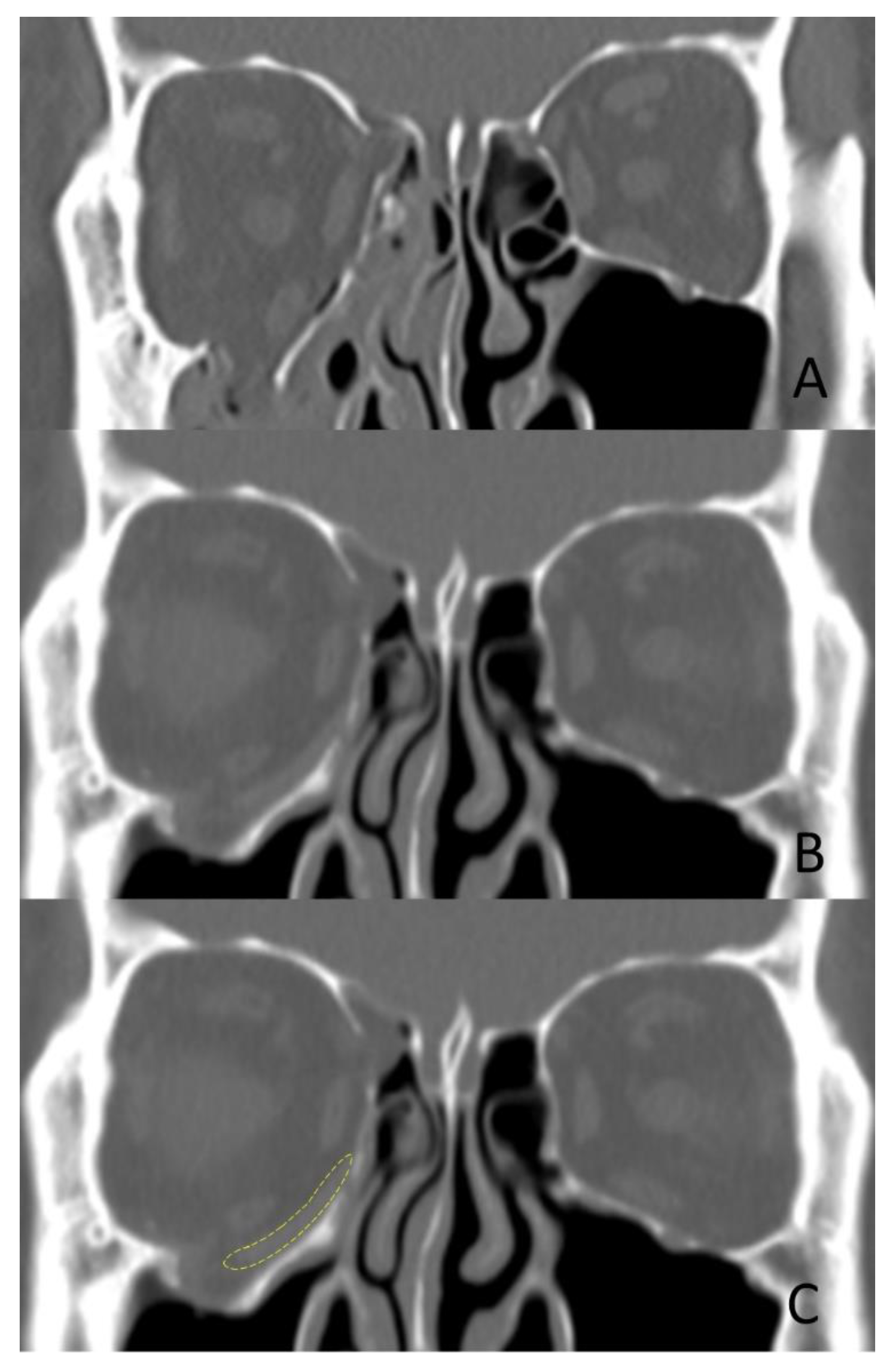 Applsci 11 07971 g002 Applsci 11 07971 g002