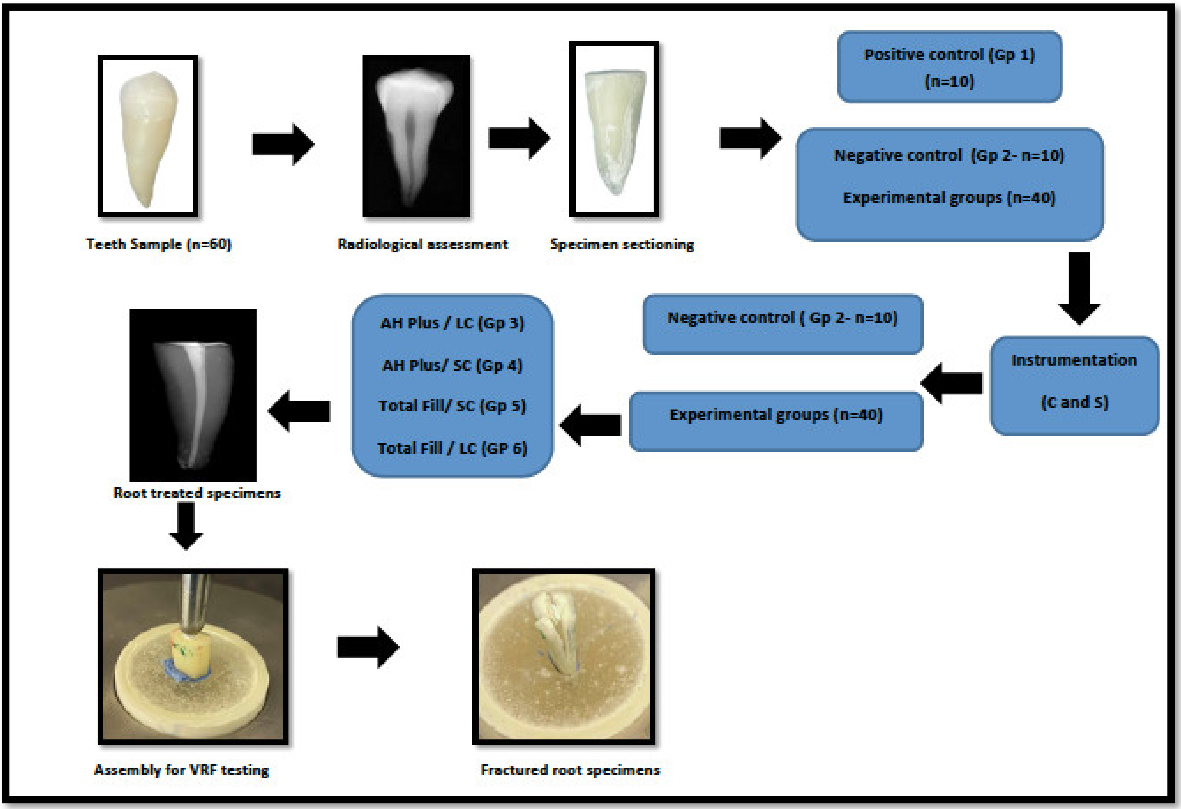 Applied Sciences Free FullText Influence of Root Canal Sealers and