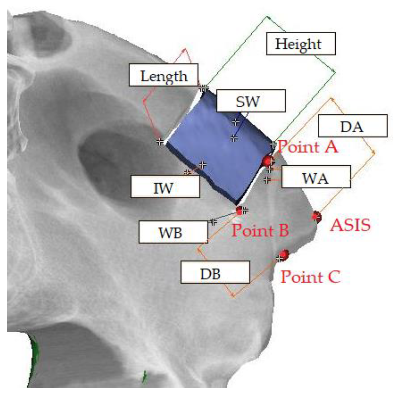 Applsci 11 08081 g002 Applsci 11 08081 g002