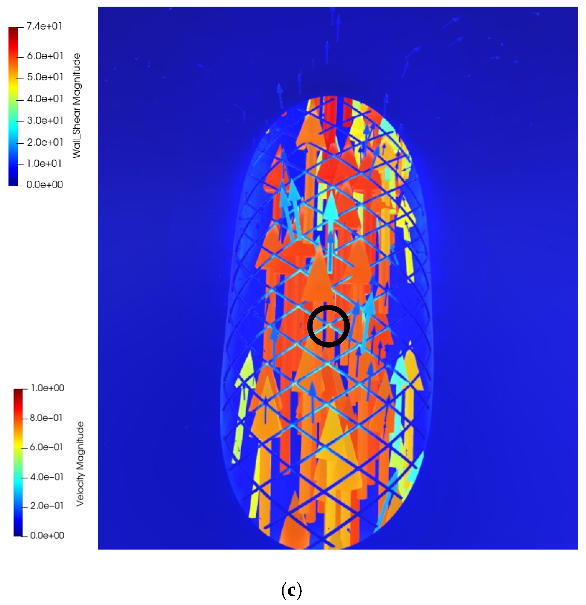 Beskrivelse modul Bestil Applied Sciences | Free Full-Text | Virtual Reality Visualization of CFD  Simulated Blood Flow in Cerebral Aneurysms Treated with Flow Diverter Stents