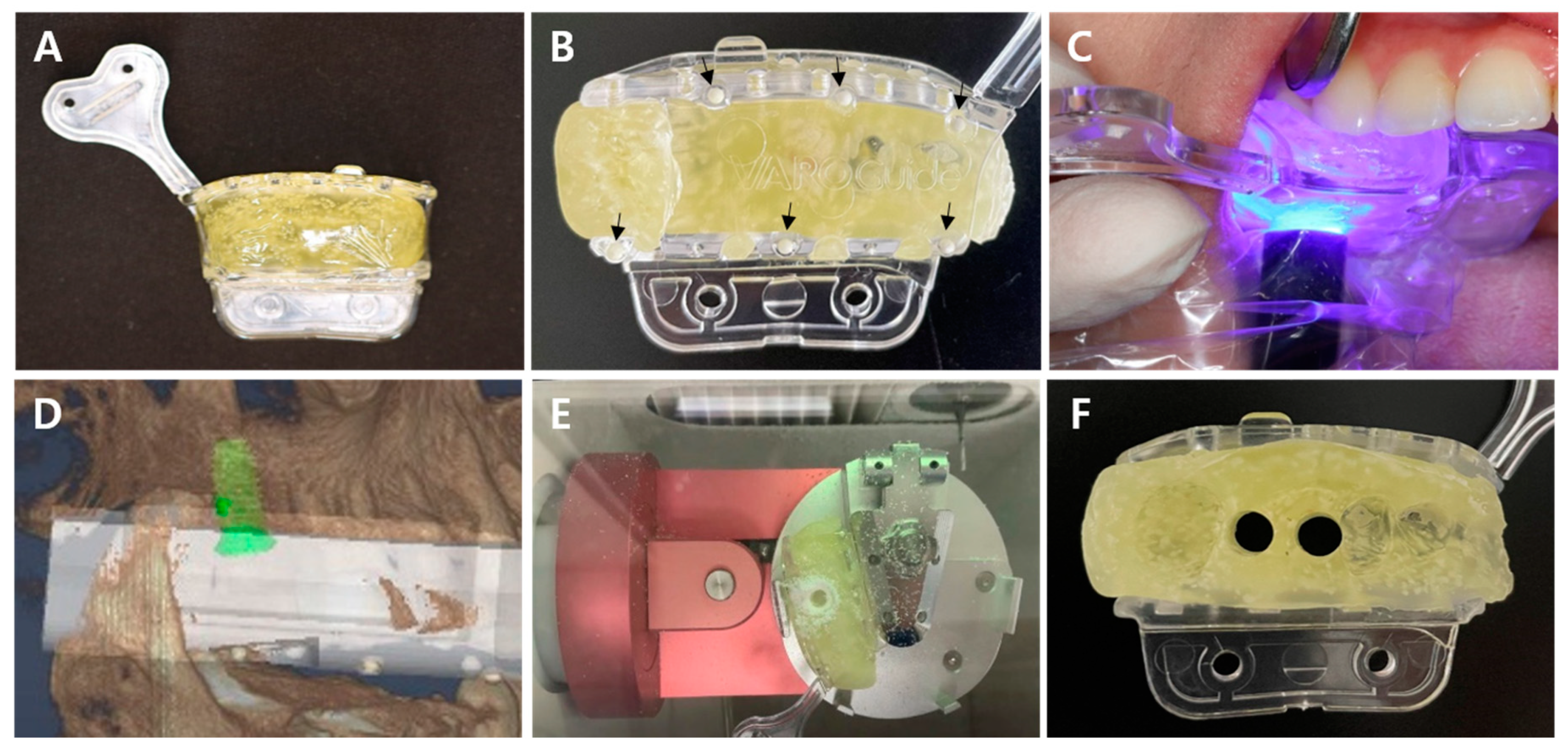 Applsci 11 08085 g001