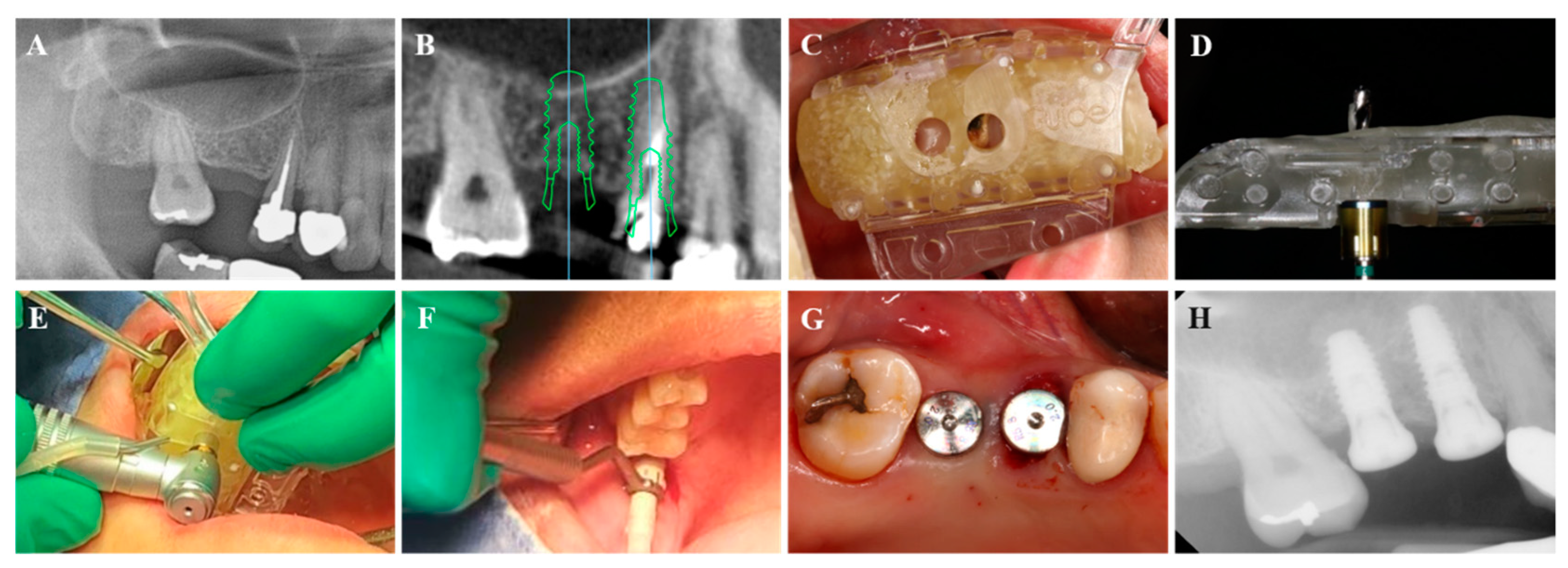Applsci 11 08085 g002