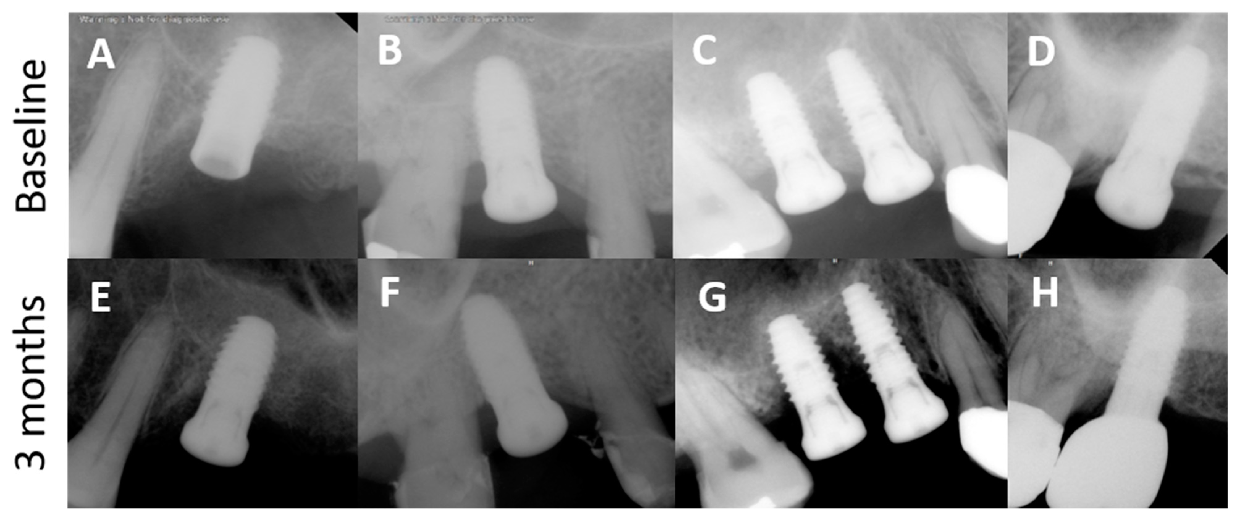 Applsci 11 08085 g004