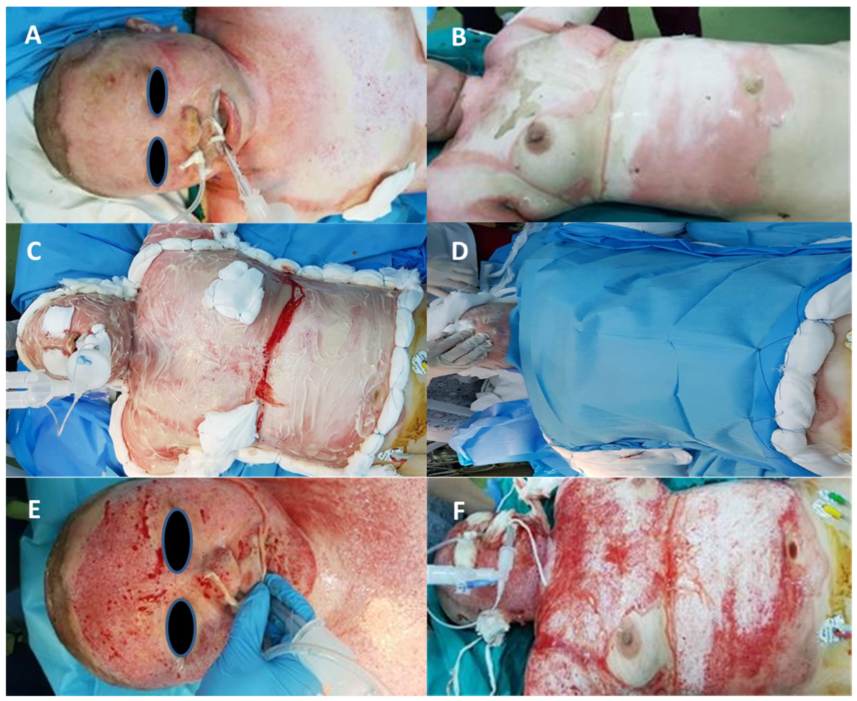 Applsci 11 08134 g003 550