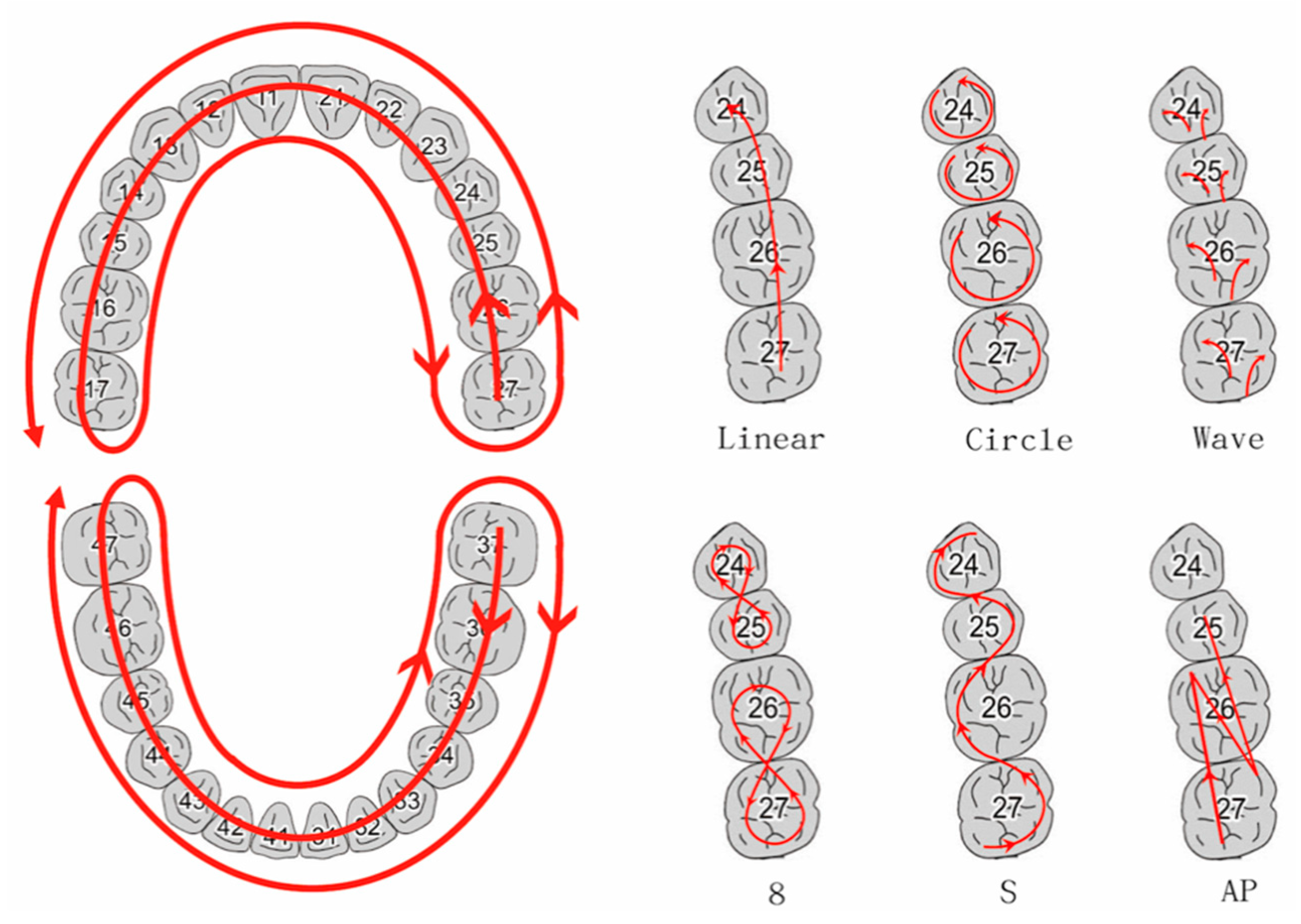 Can you use an intraoral scanner for upper jaw impressions