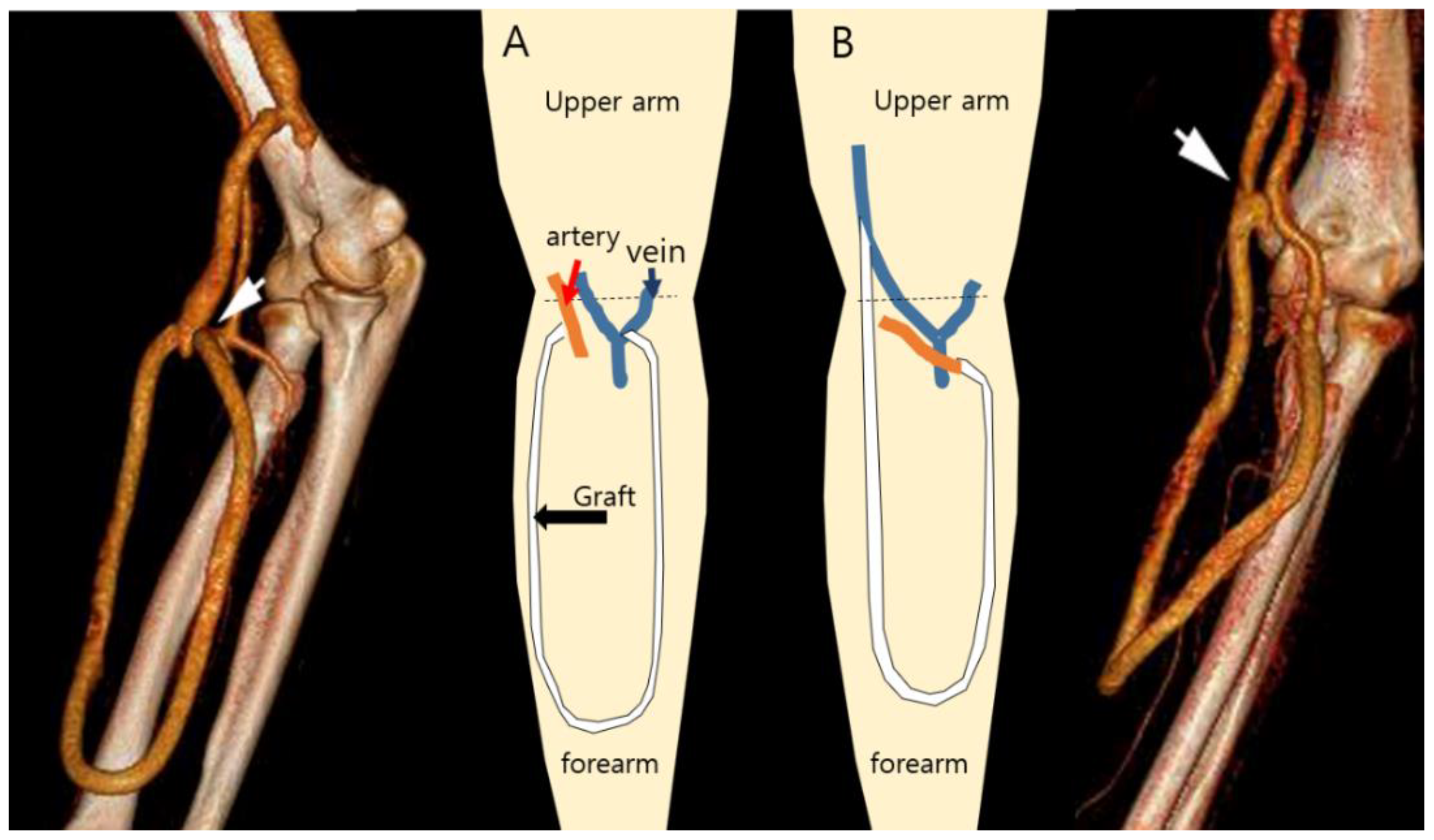 Applied Sciences Free FullText Hemodynamic Analysis on the