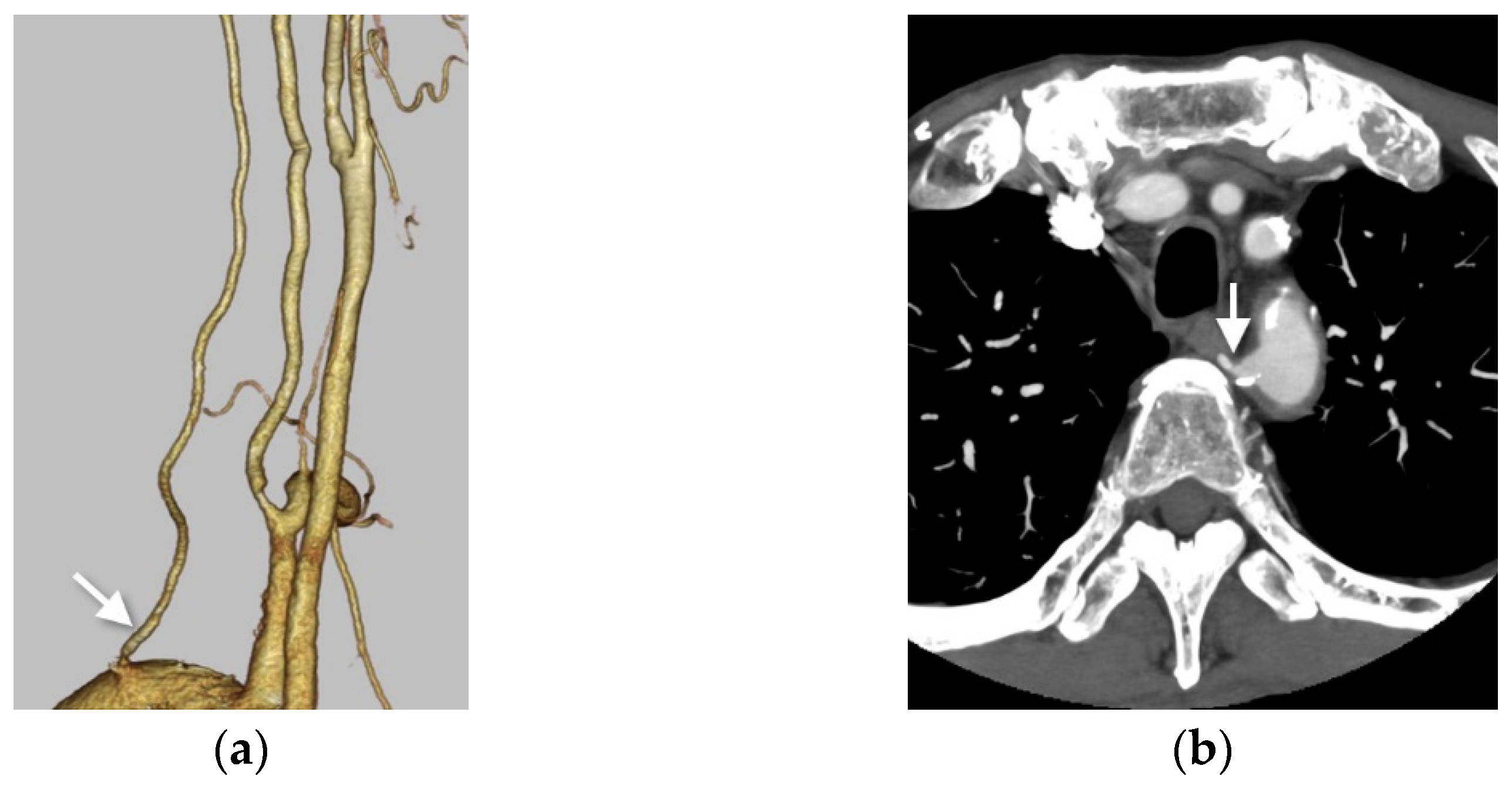 Applsci 11 08171 g003