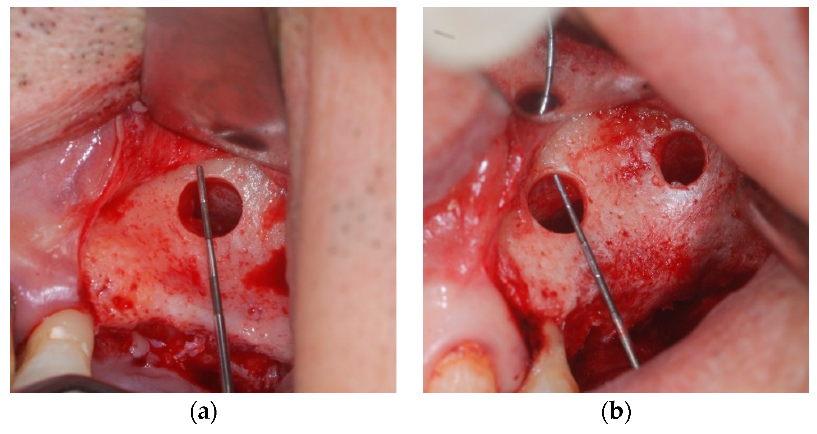 Applsci 11 08244 g002 Applsci 11 08244 g002
