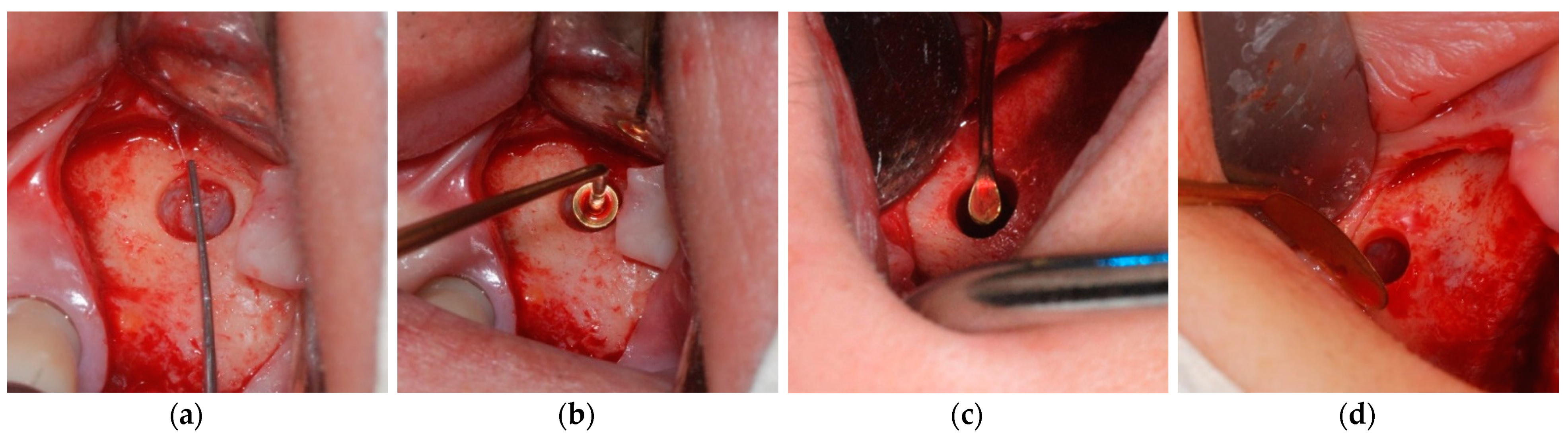 Applsci 11 08244 g003 Applsci 11 08244 g003