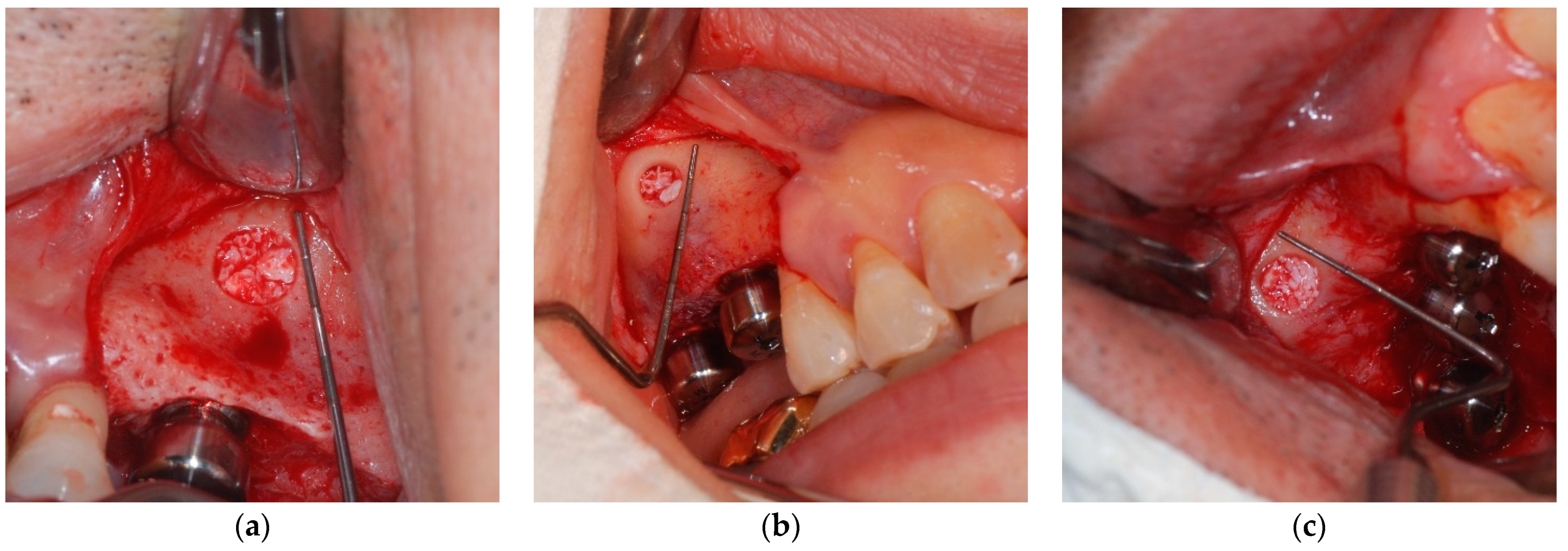 Applsci 11 08244 g004 Applsci 11 08244 g004