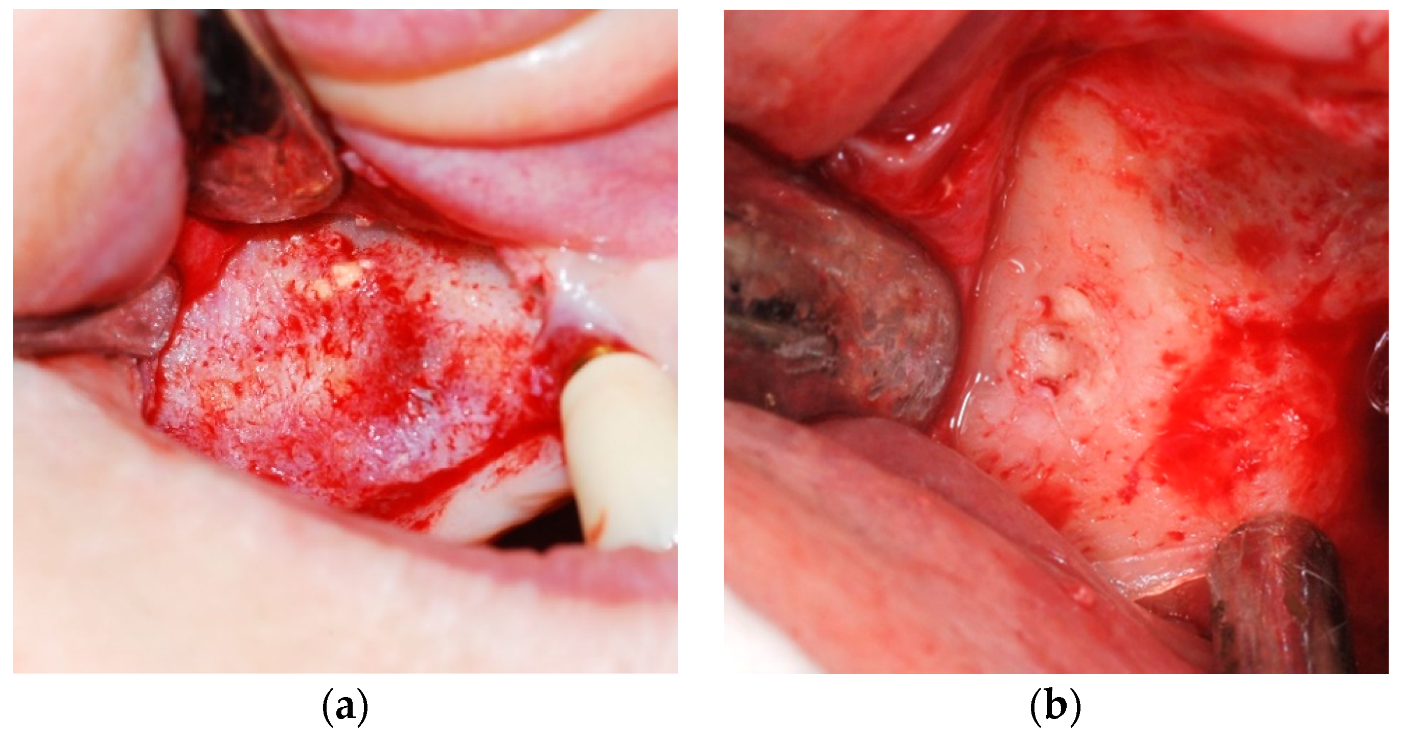 Applsci 11 08244 g005 Applsci 11 08244 g005