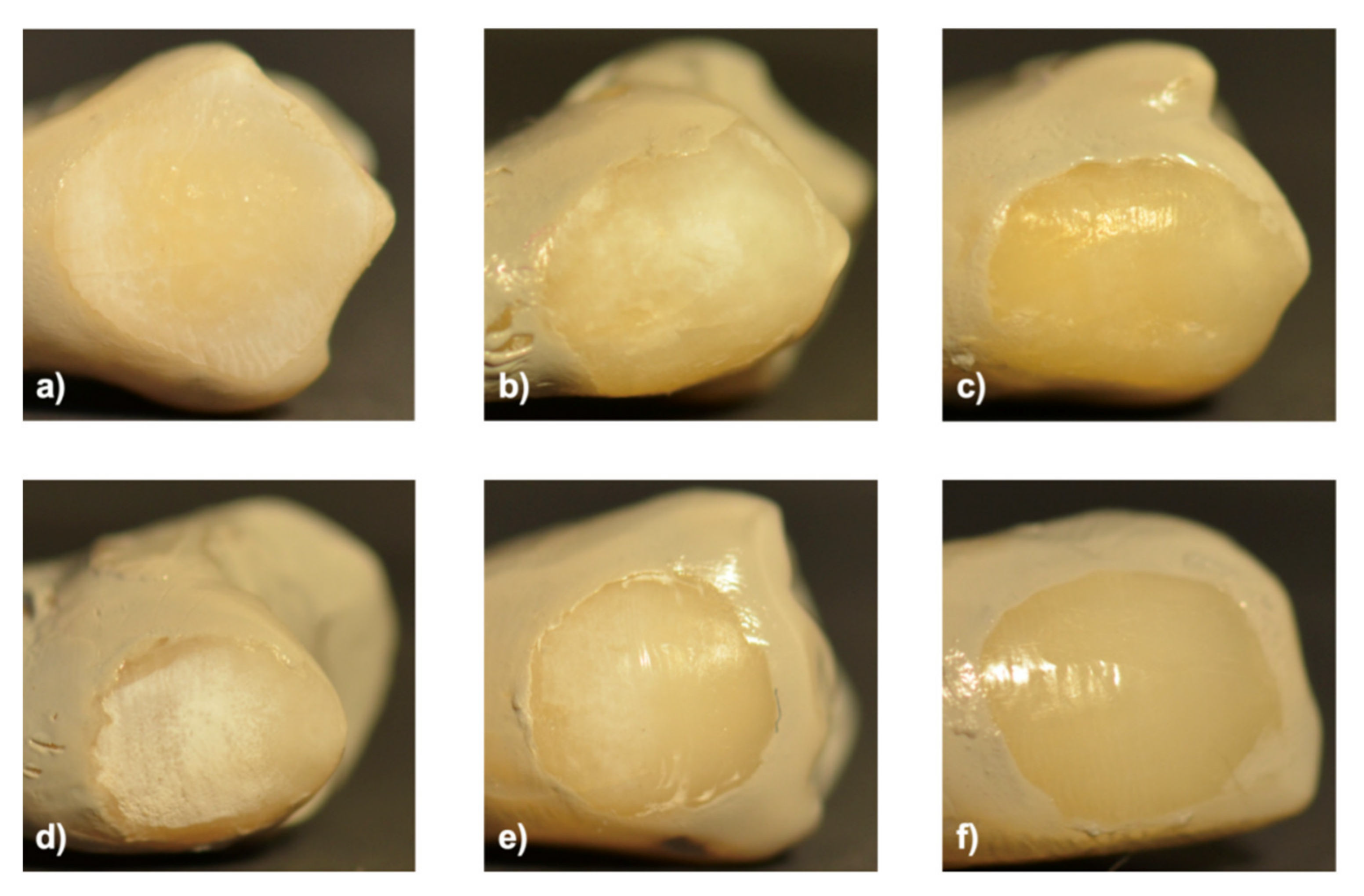 An Evaluation of the Demineralizing Effects of Various Acidic 