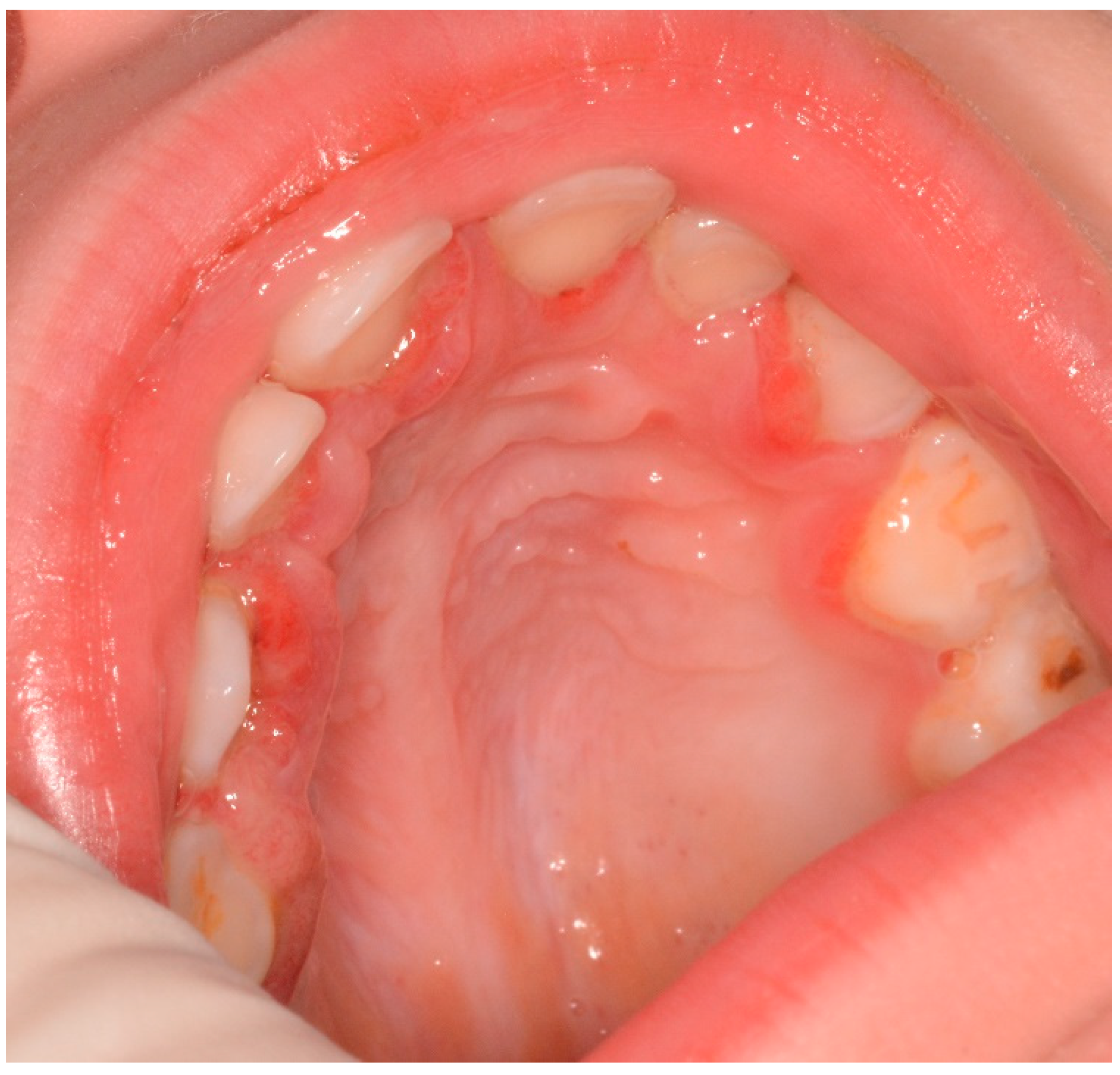 Applied Sciences Free FullText Oral Manifestations in Scurvy
