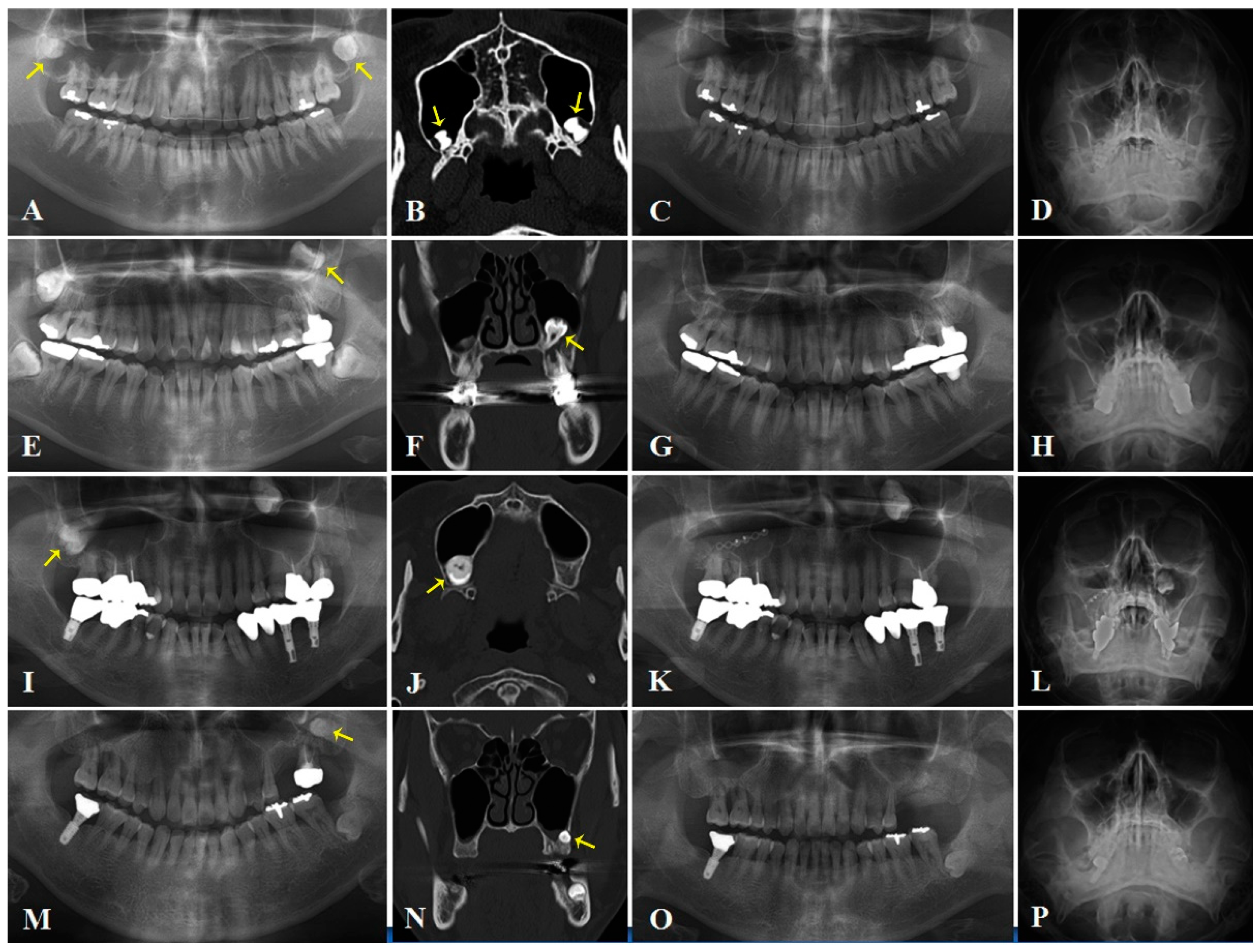 Applsci 11 08446 g001 550