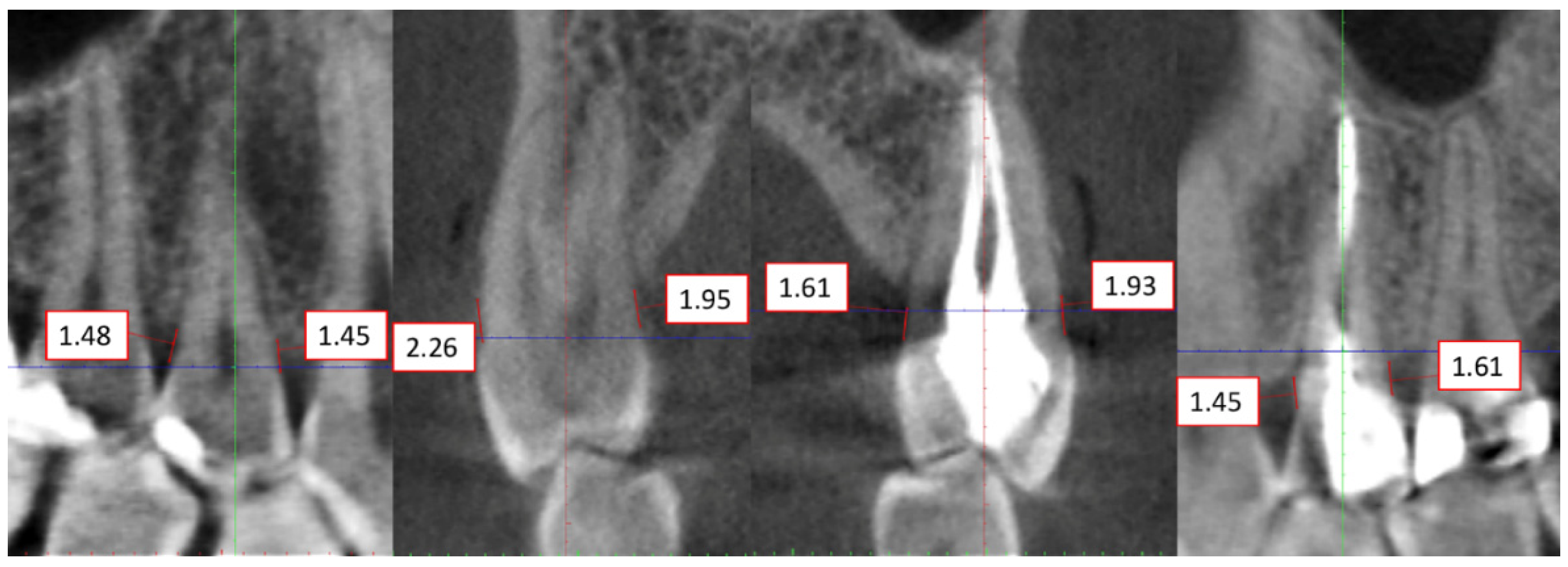 Applsci 11 08583 g001