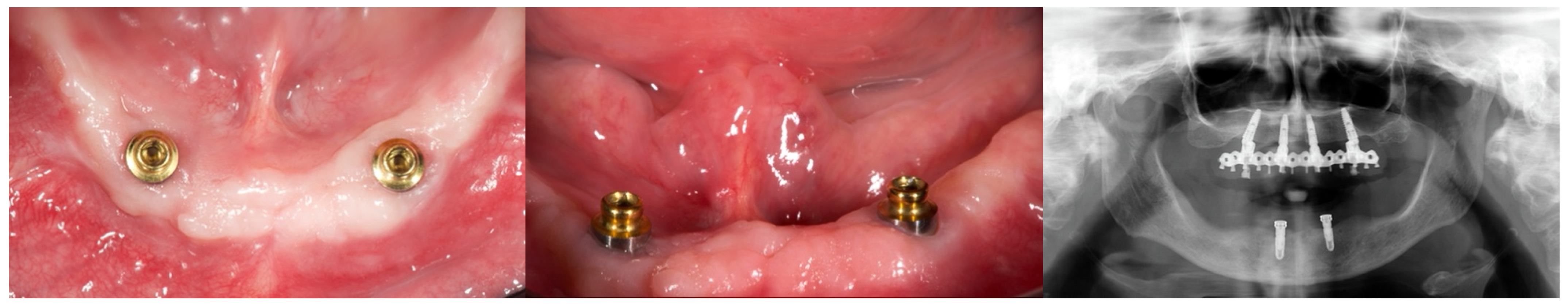 Applsci 11 08601 g002 550