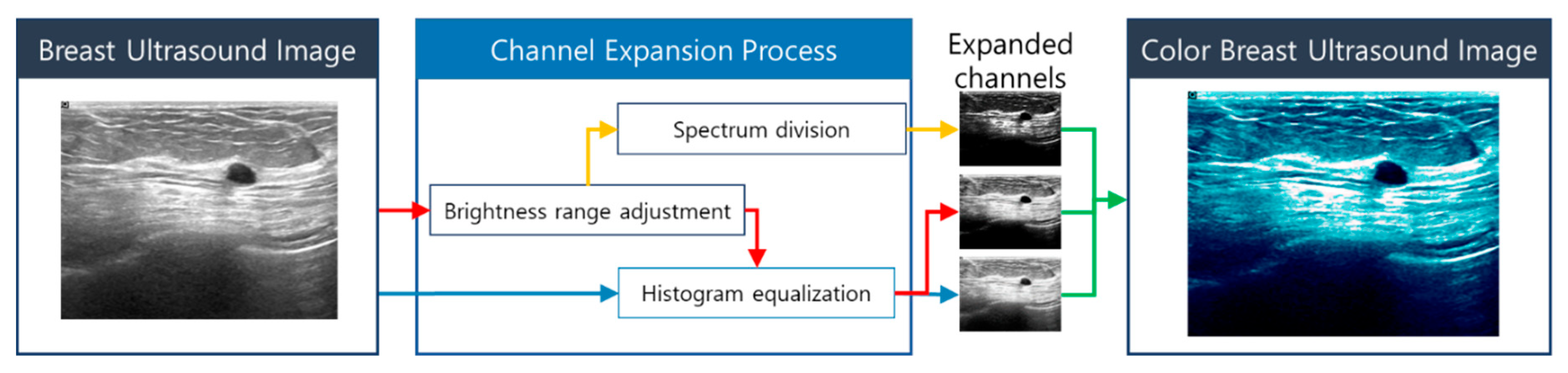 Applsci 11 08621 g004