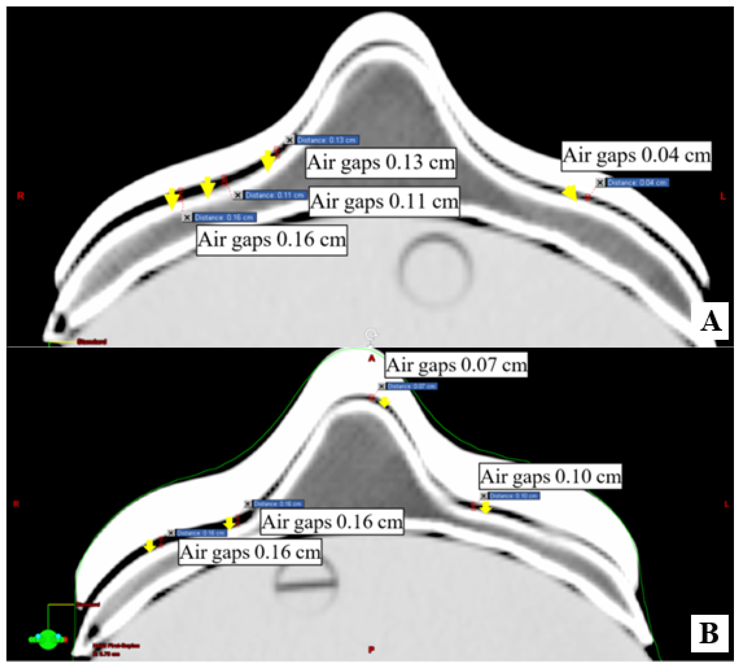 Applsci 11 08657 g006 Applsci 11 08657 g006