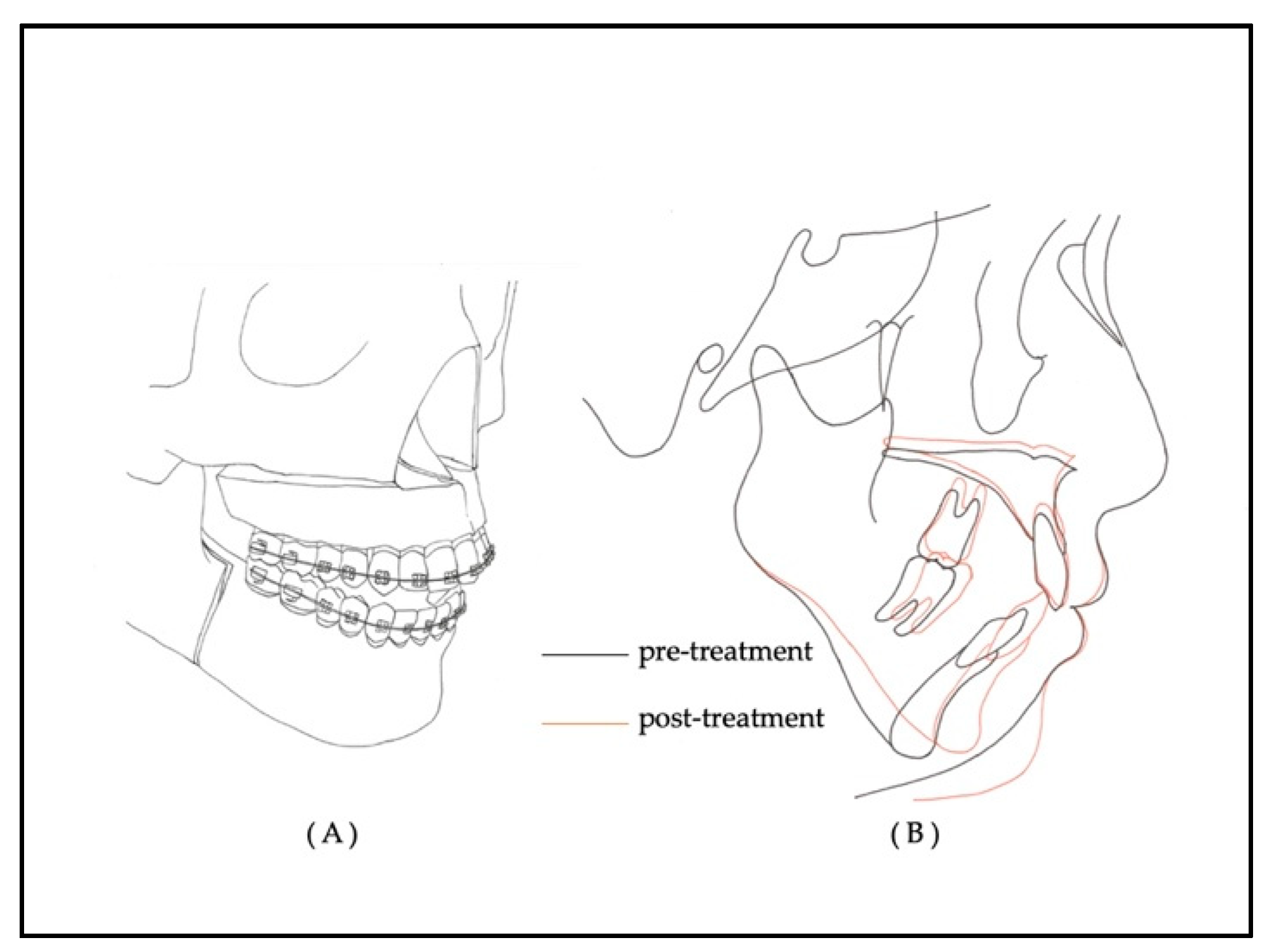 Applsci 11 08736 g001 550