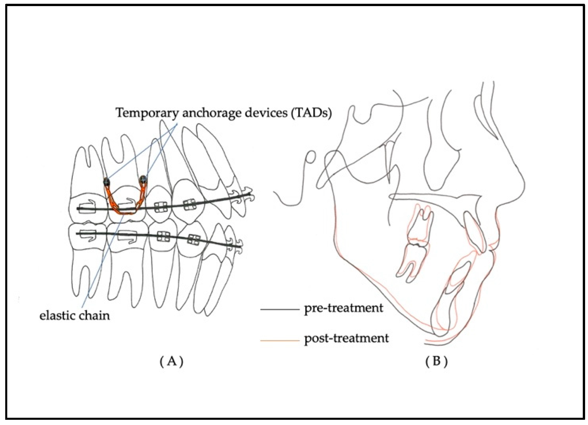 Applsci 11 08736 g003 550
